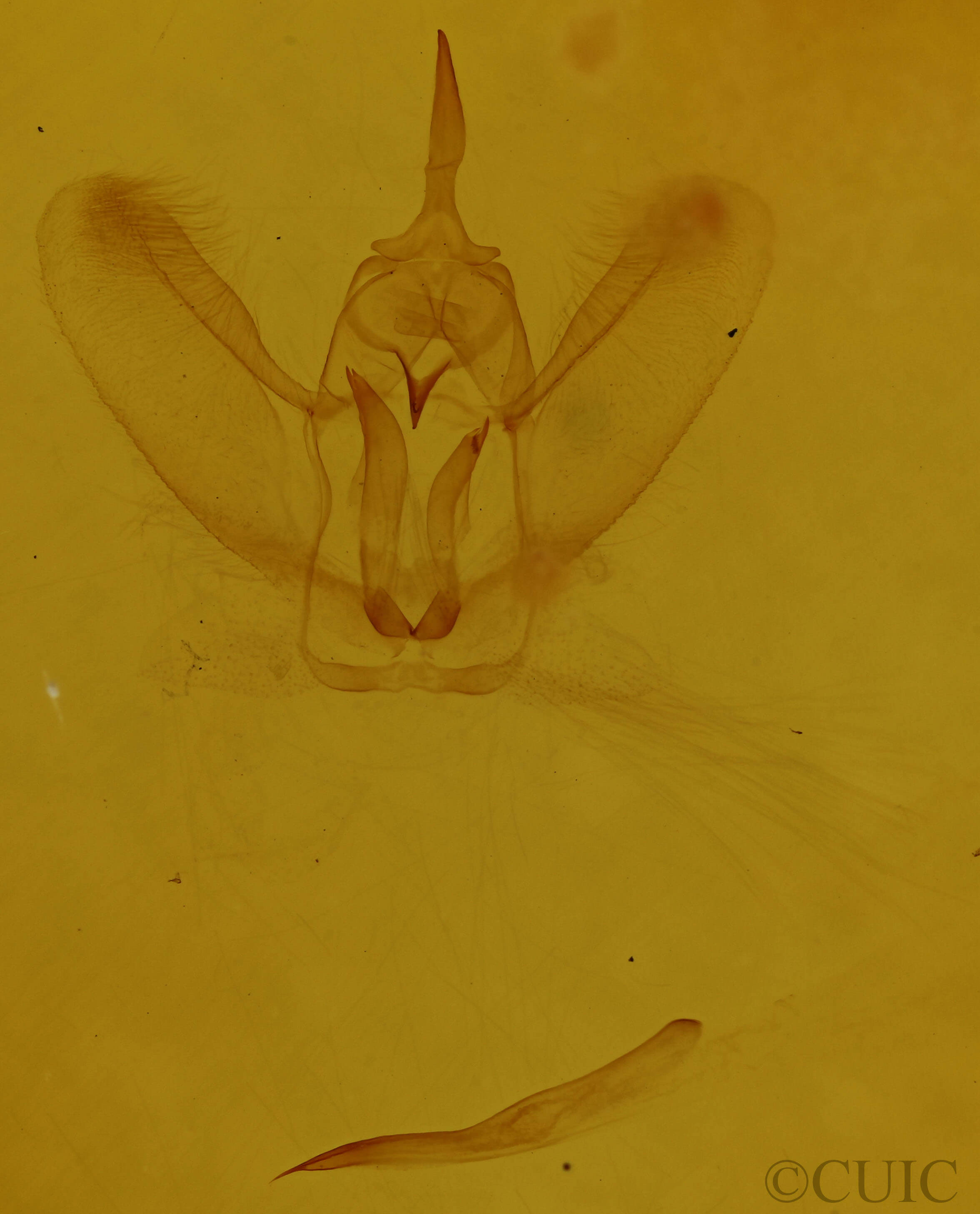 genitalia view of adult Metarranthis warneri