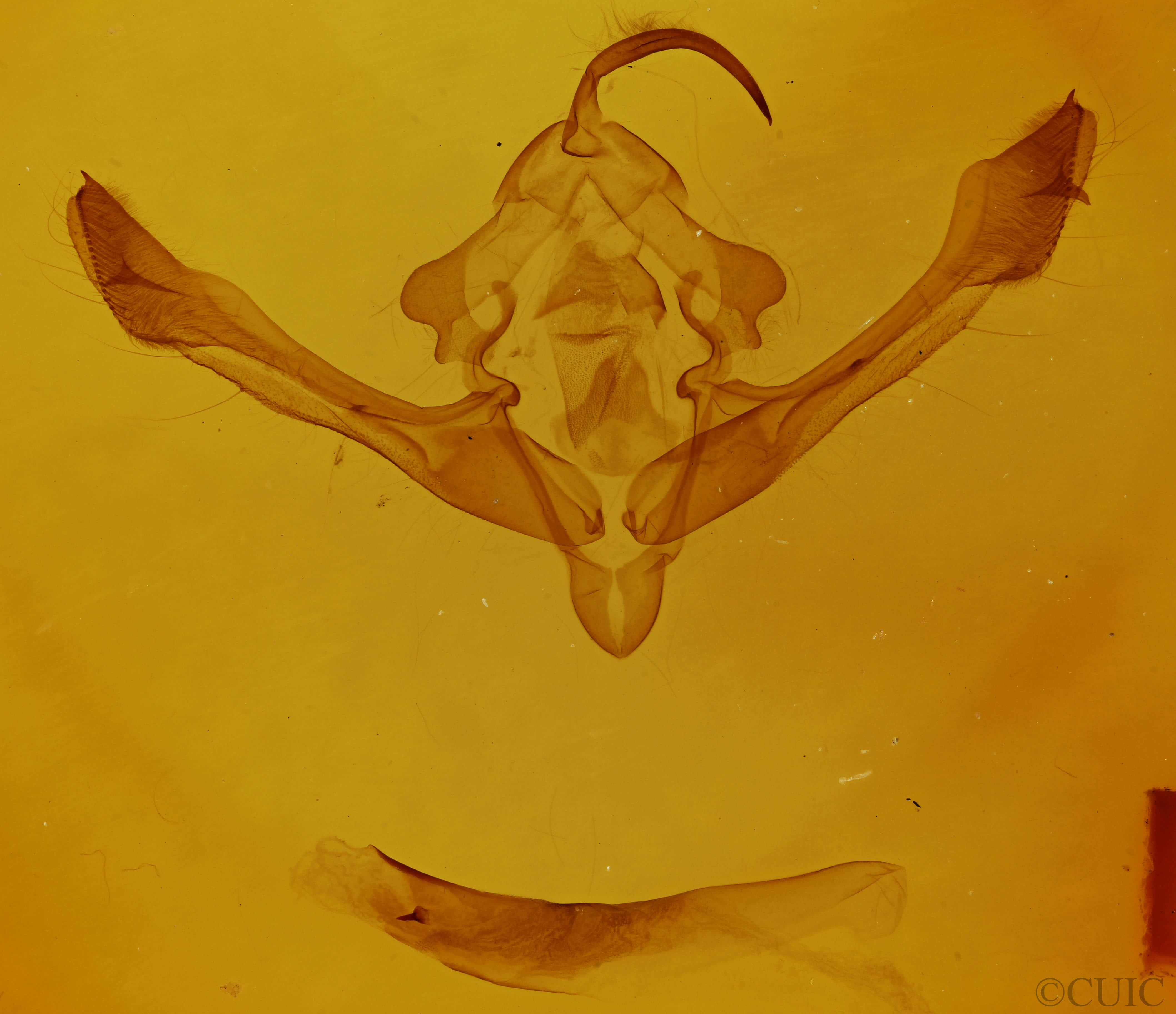 genitalia view of adult Metaxaglaea inulta