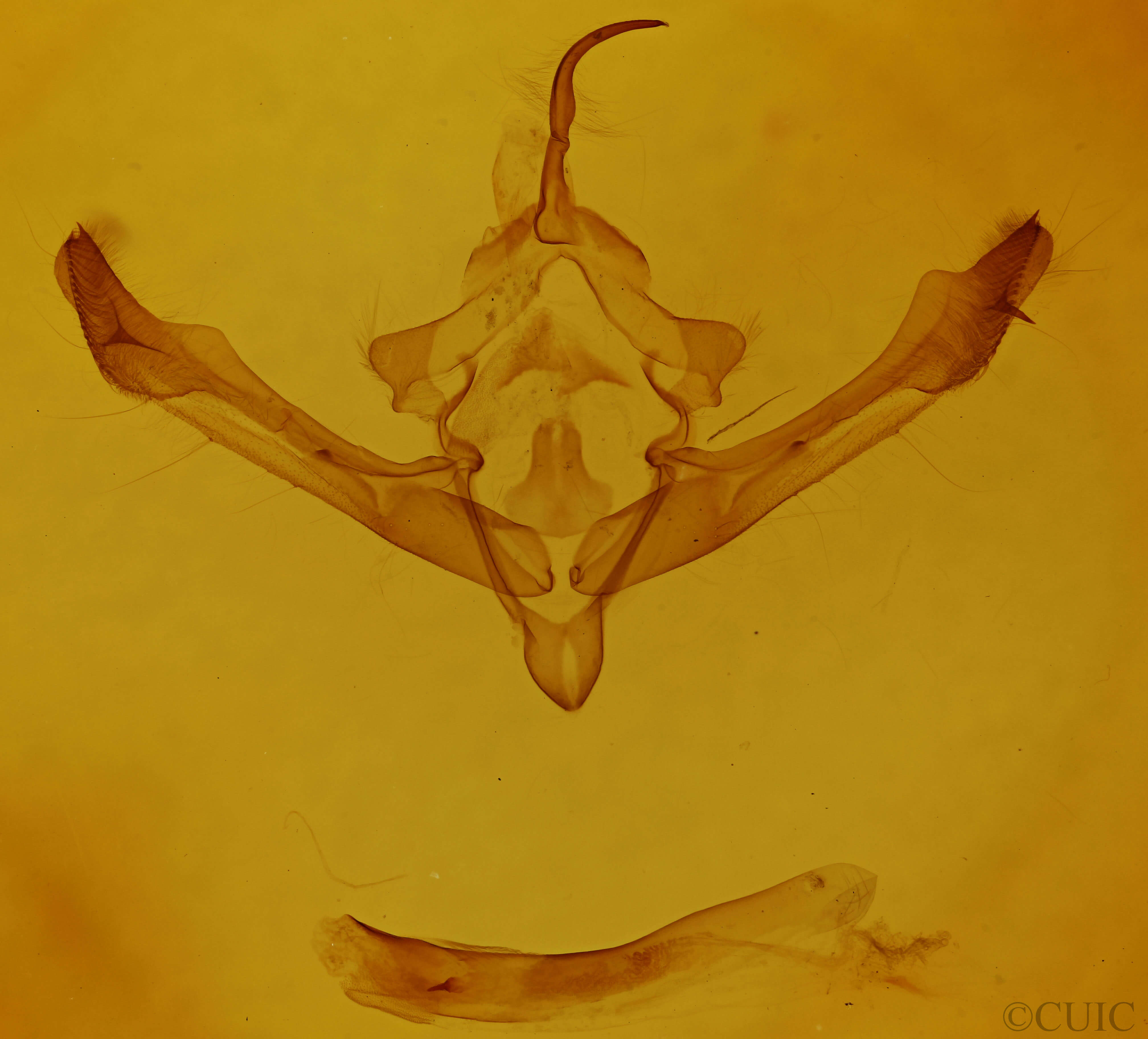 genitalia view of adult Metaxaglaea inulta