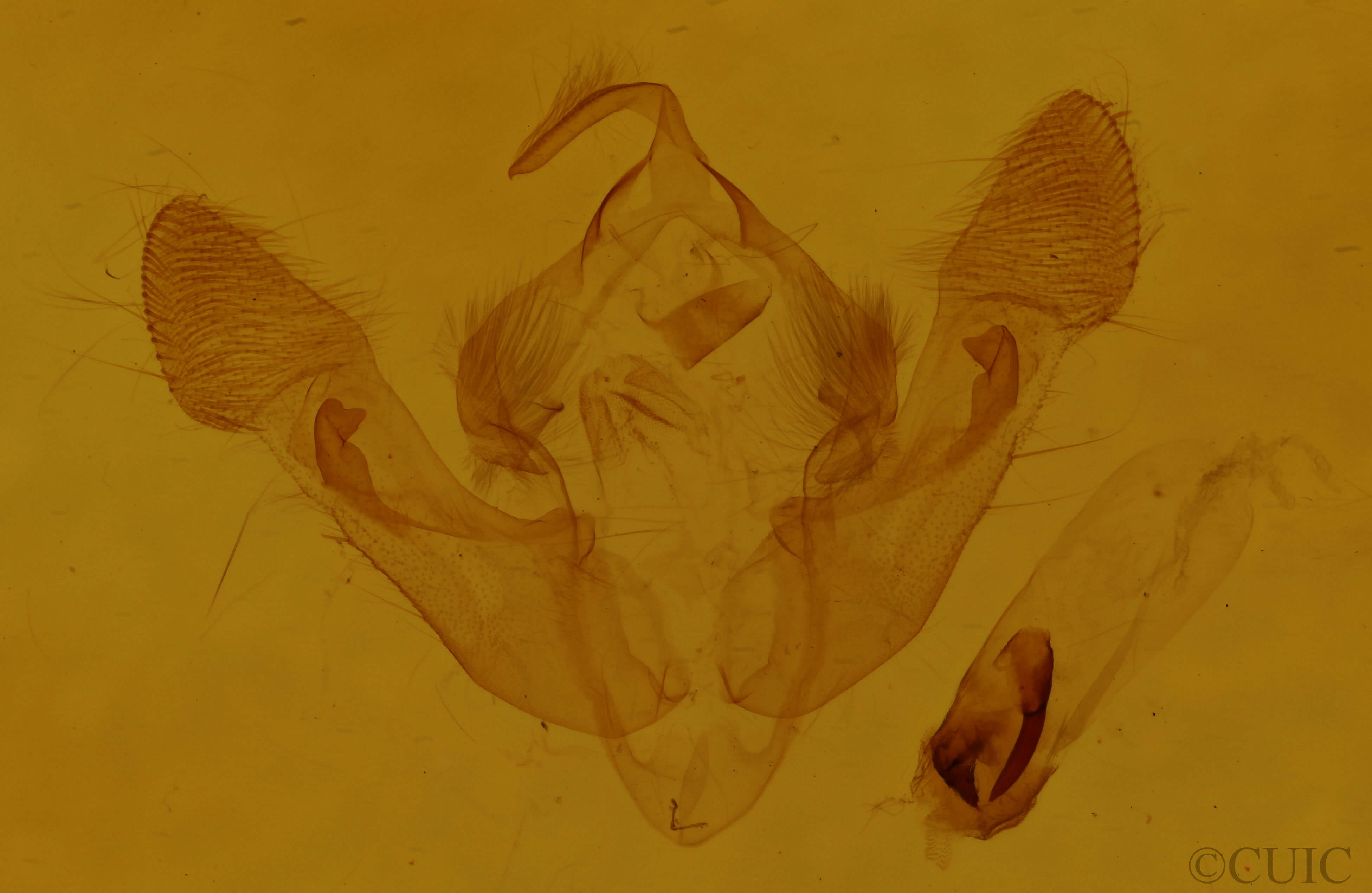 genitalia view of adult Oligia minuscula