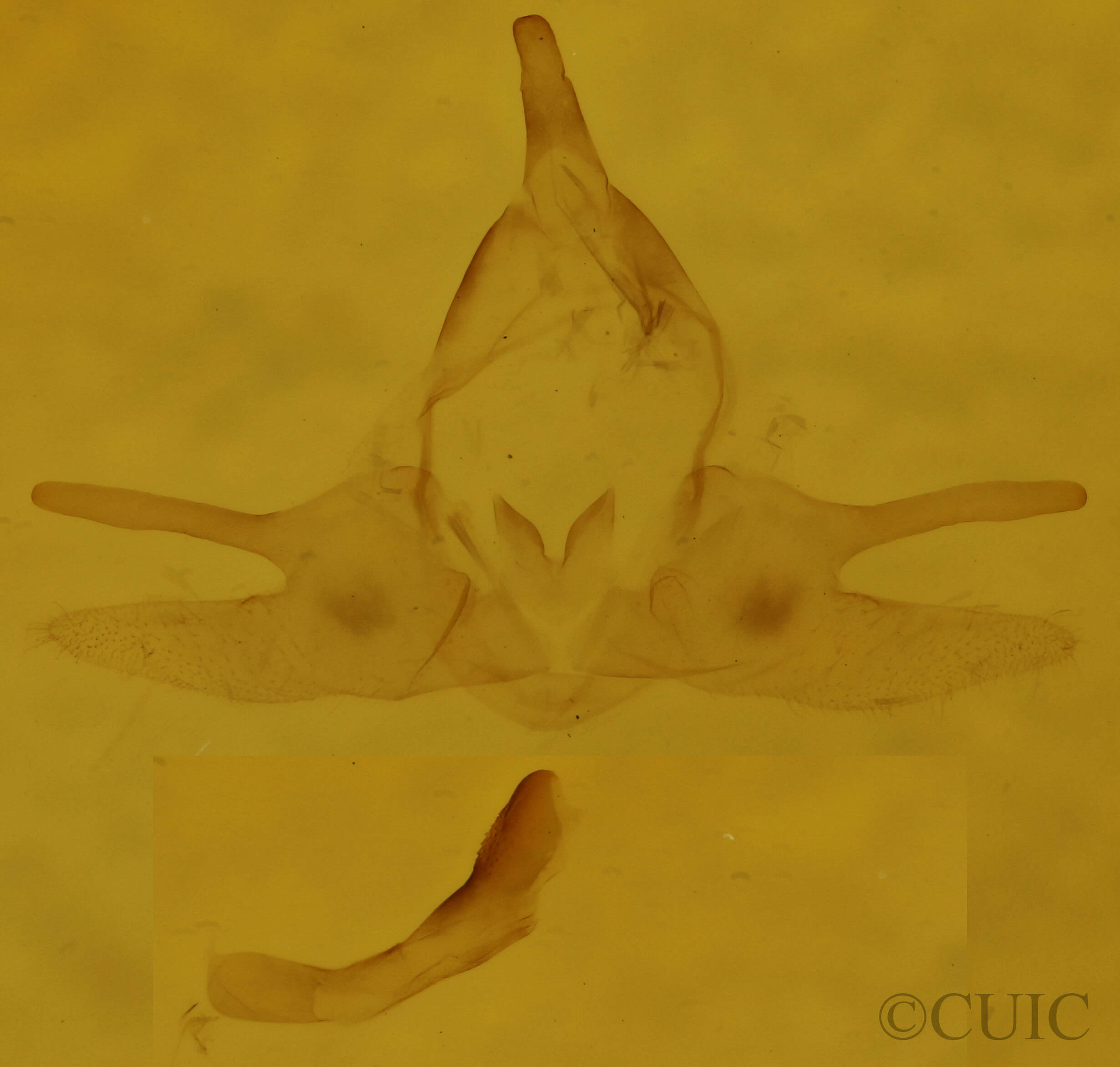 genitalia view of adult Orgyia definita