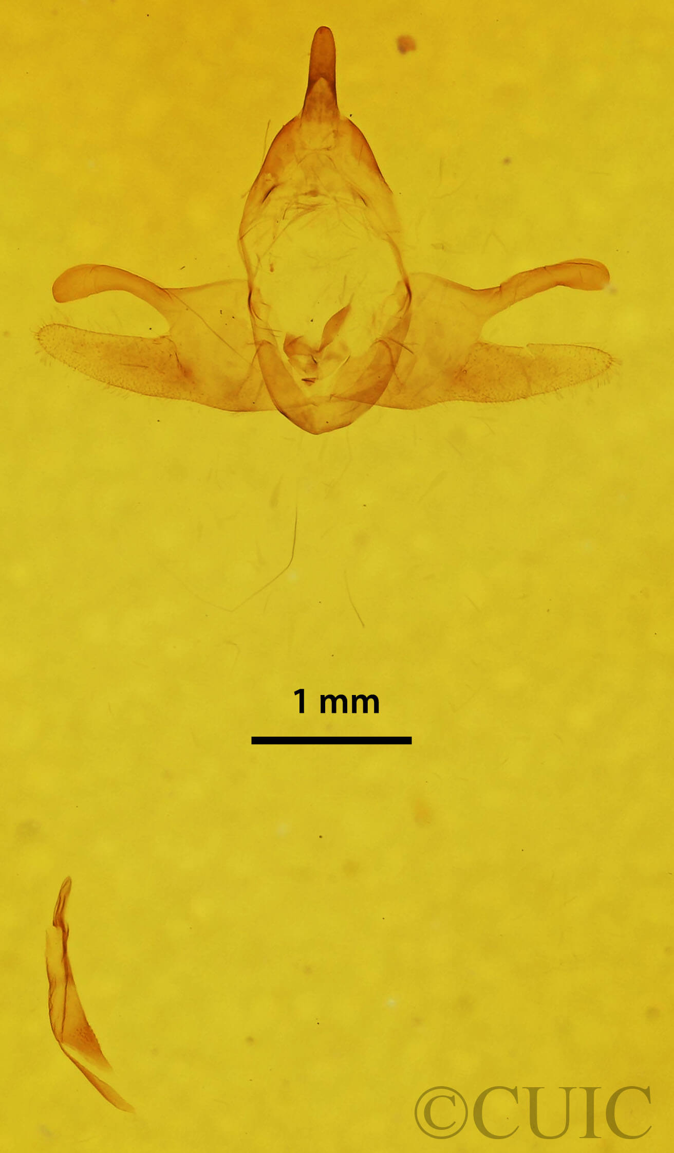 genitalia view of adult Orgyia leucostigma