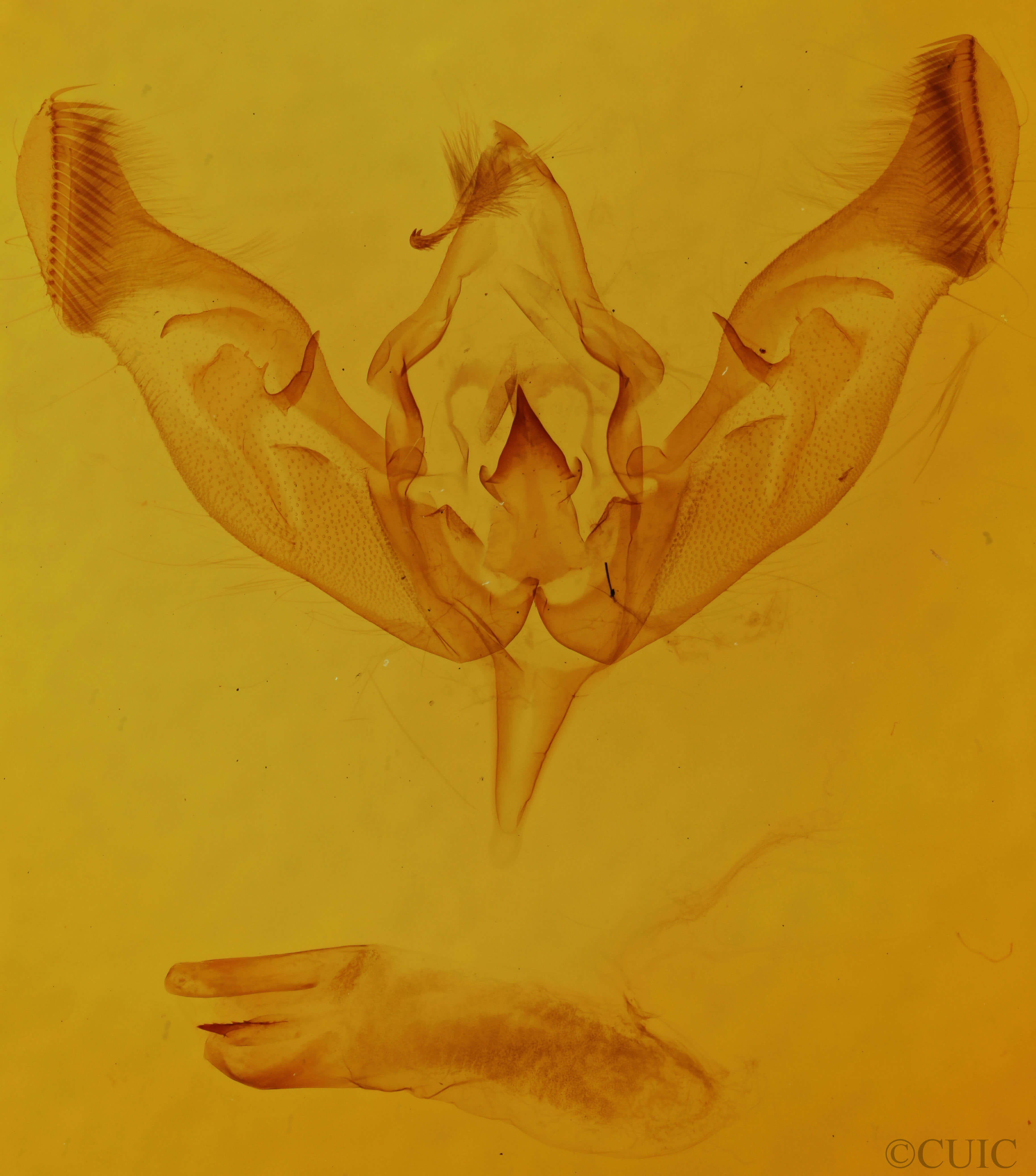 genitalia view of adult Peridroma saucia