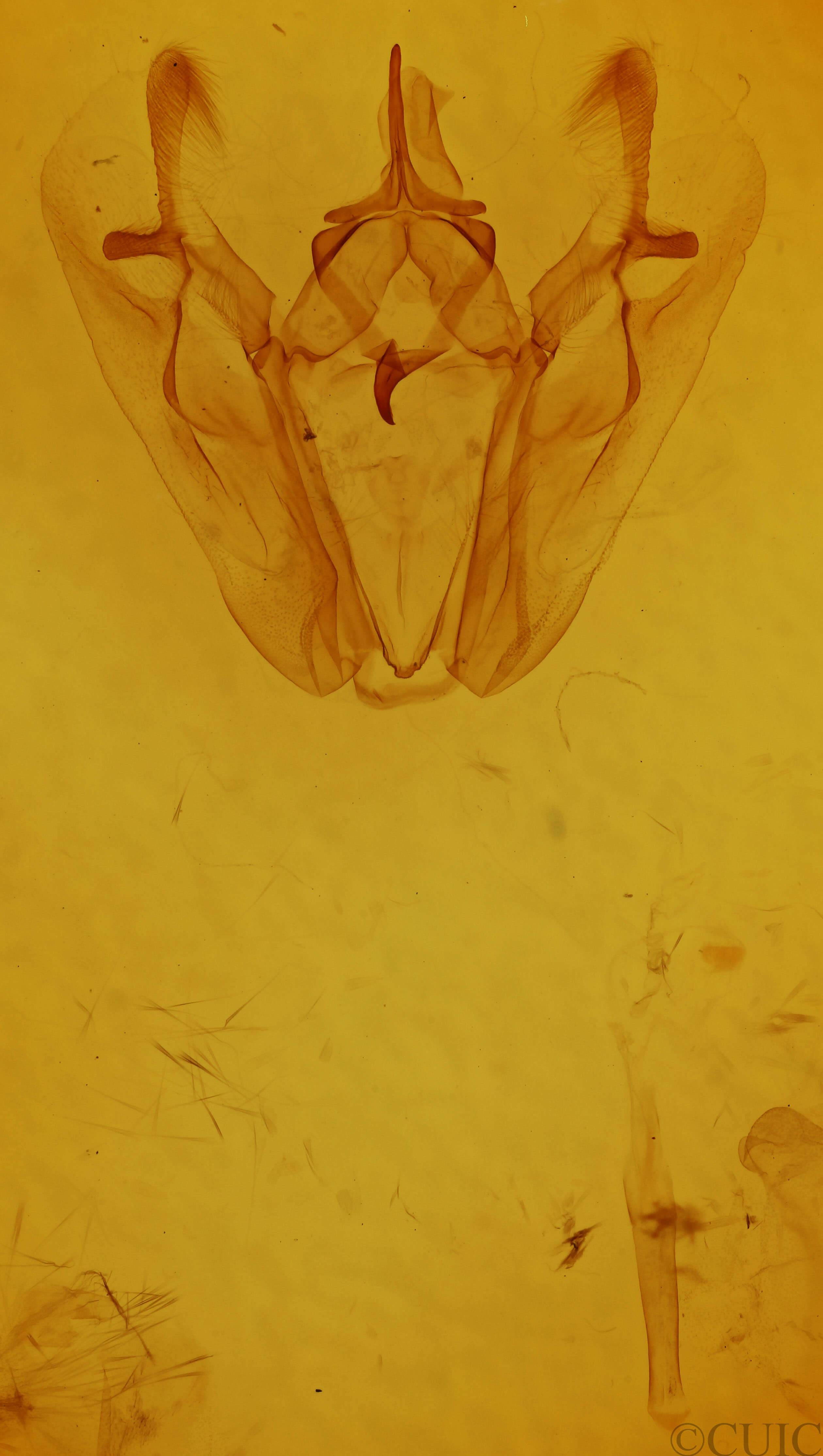 genitalia view of adult Pero ancetaria
