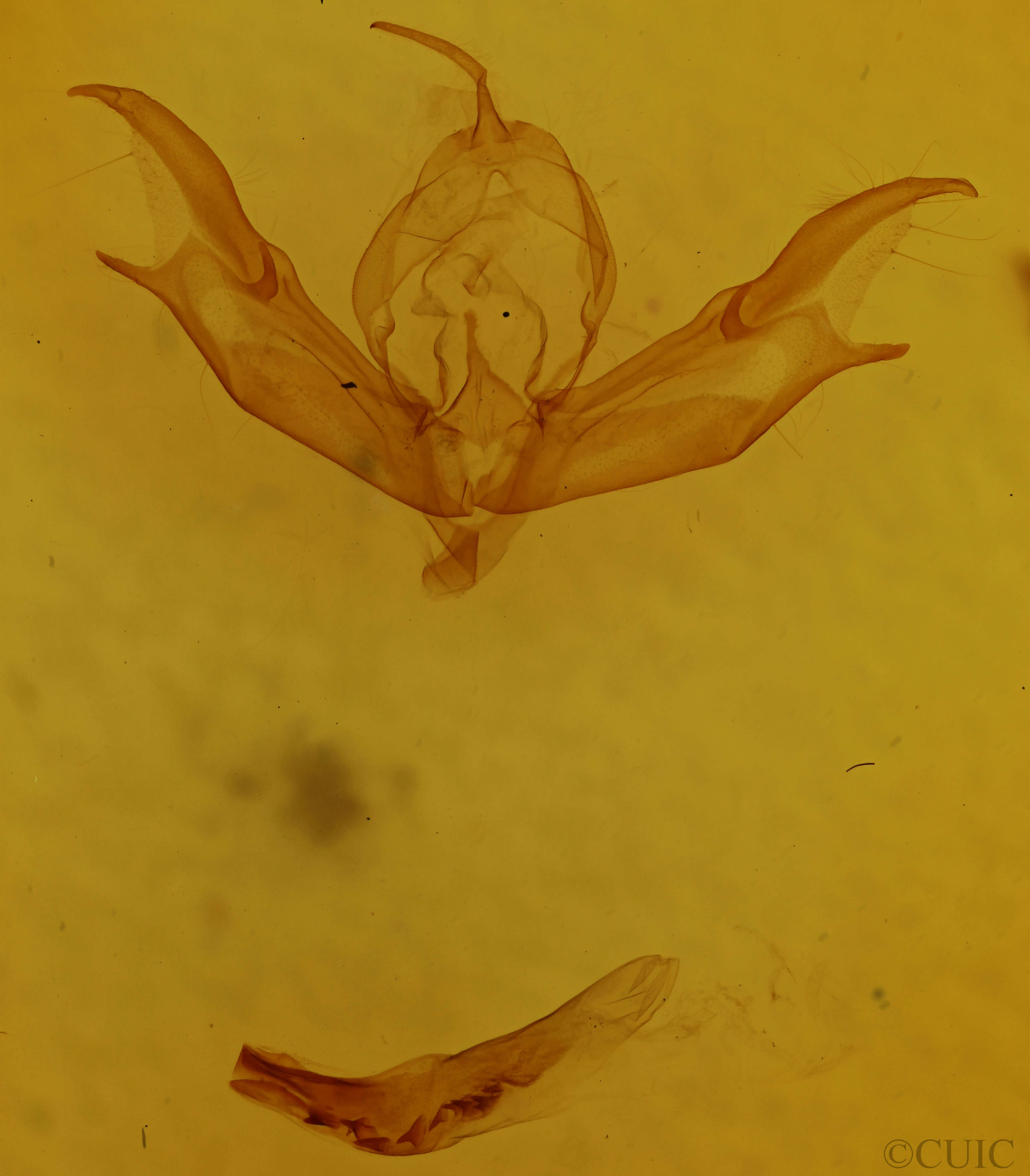 genitalia view of adult Caradrina multifera