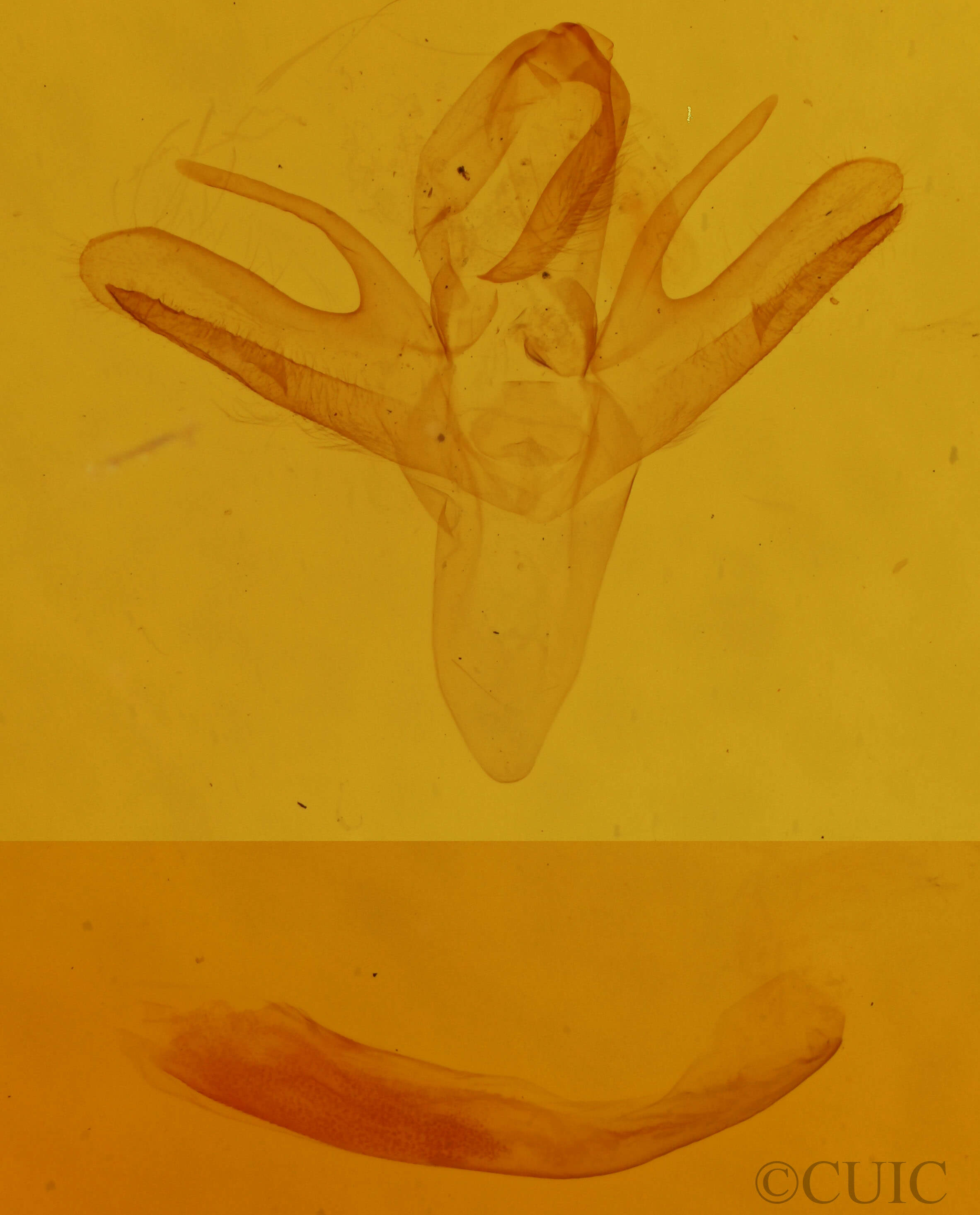 genitalia view of adult Renia discoloralis