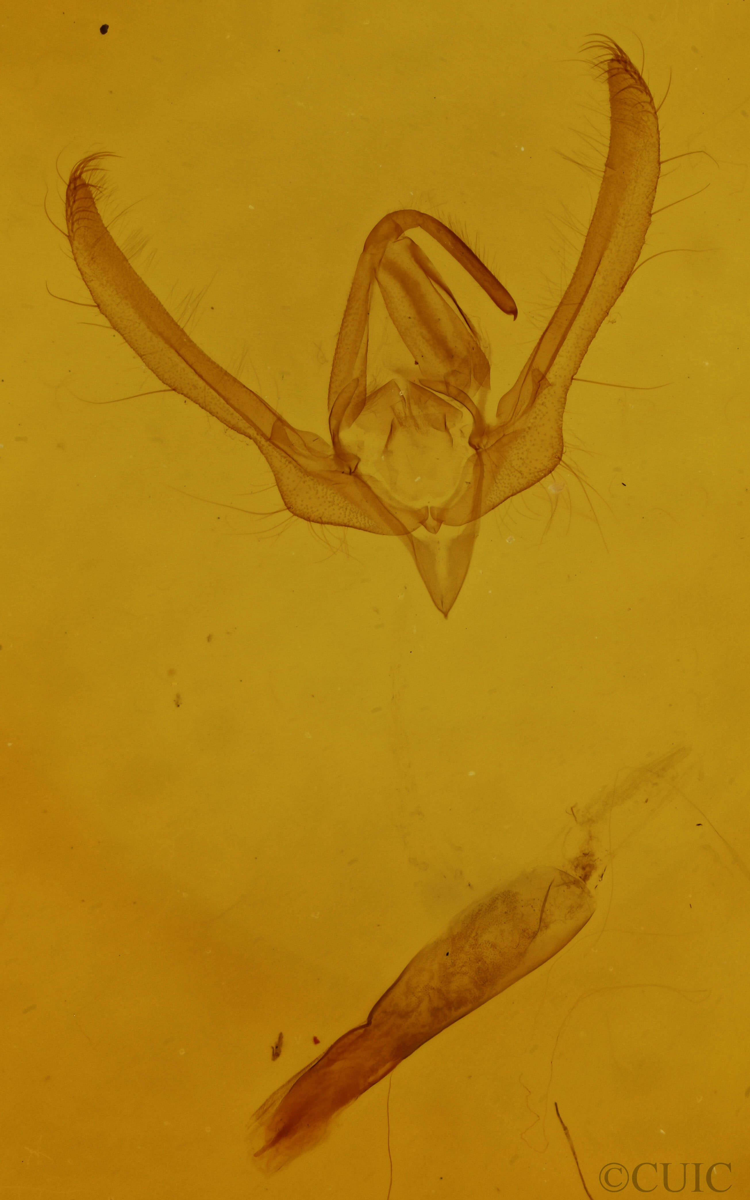 genitalia view of adult Schinia nundina
