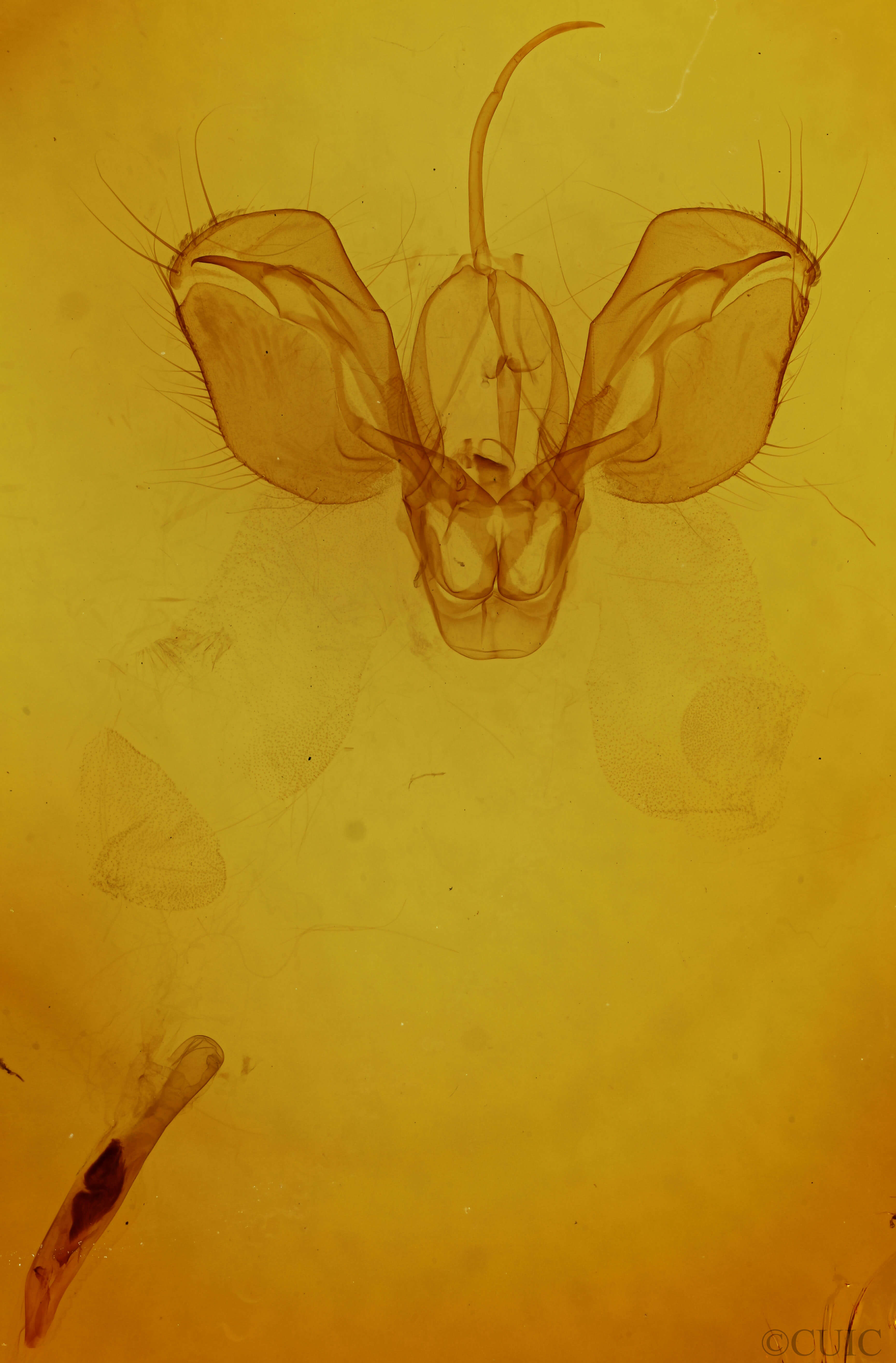 genitalia view of adult Spodoptera frugiperda