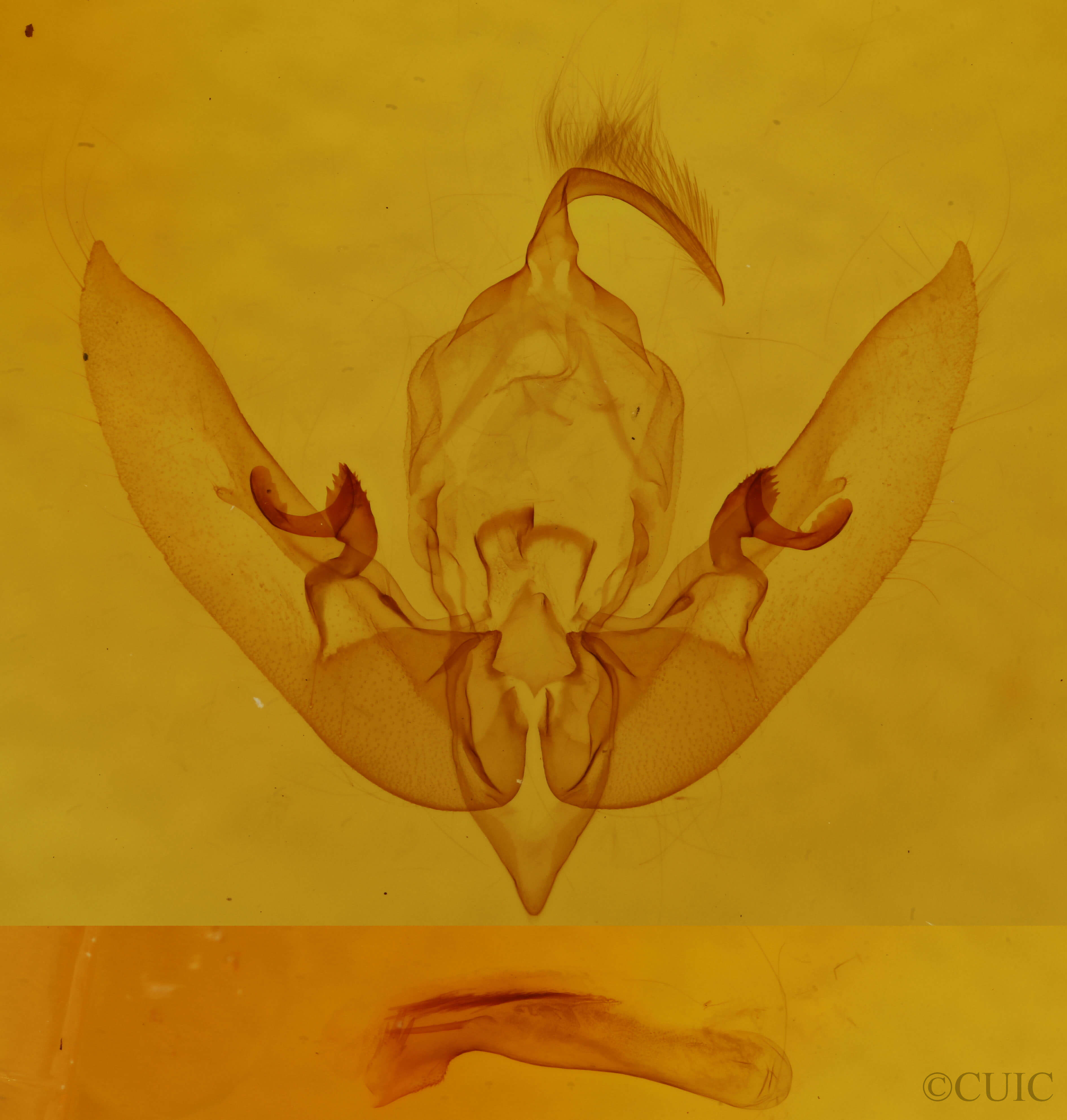 genitalia view of adult Sunira bicolorago
