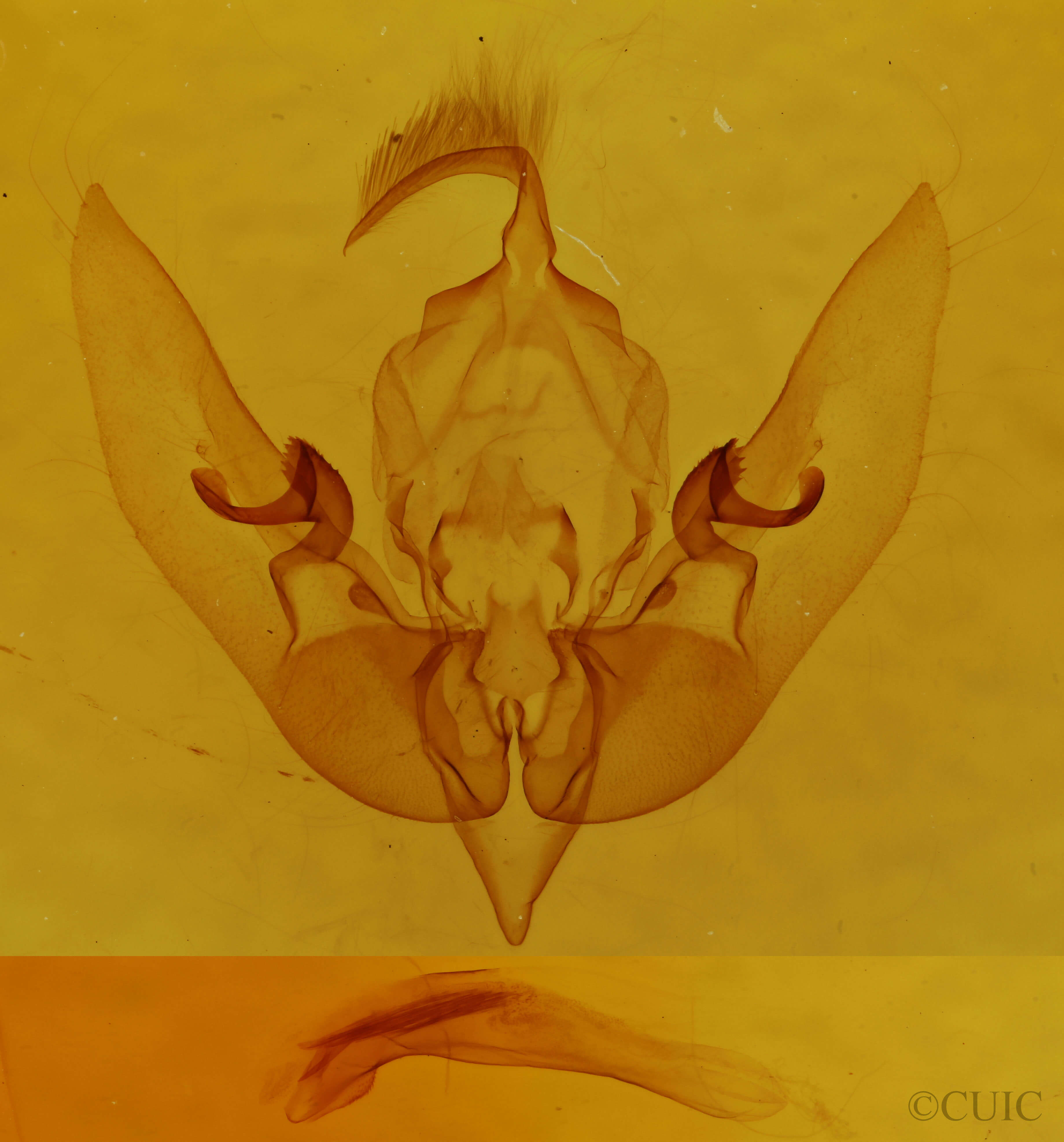 genitalia view of adult Sunira bicolorago
