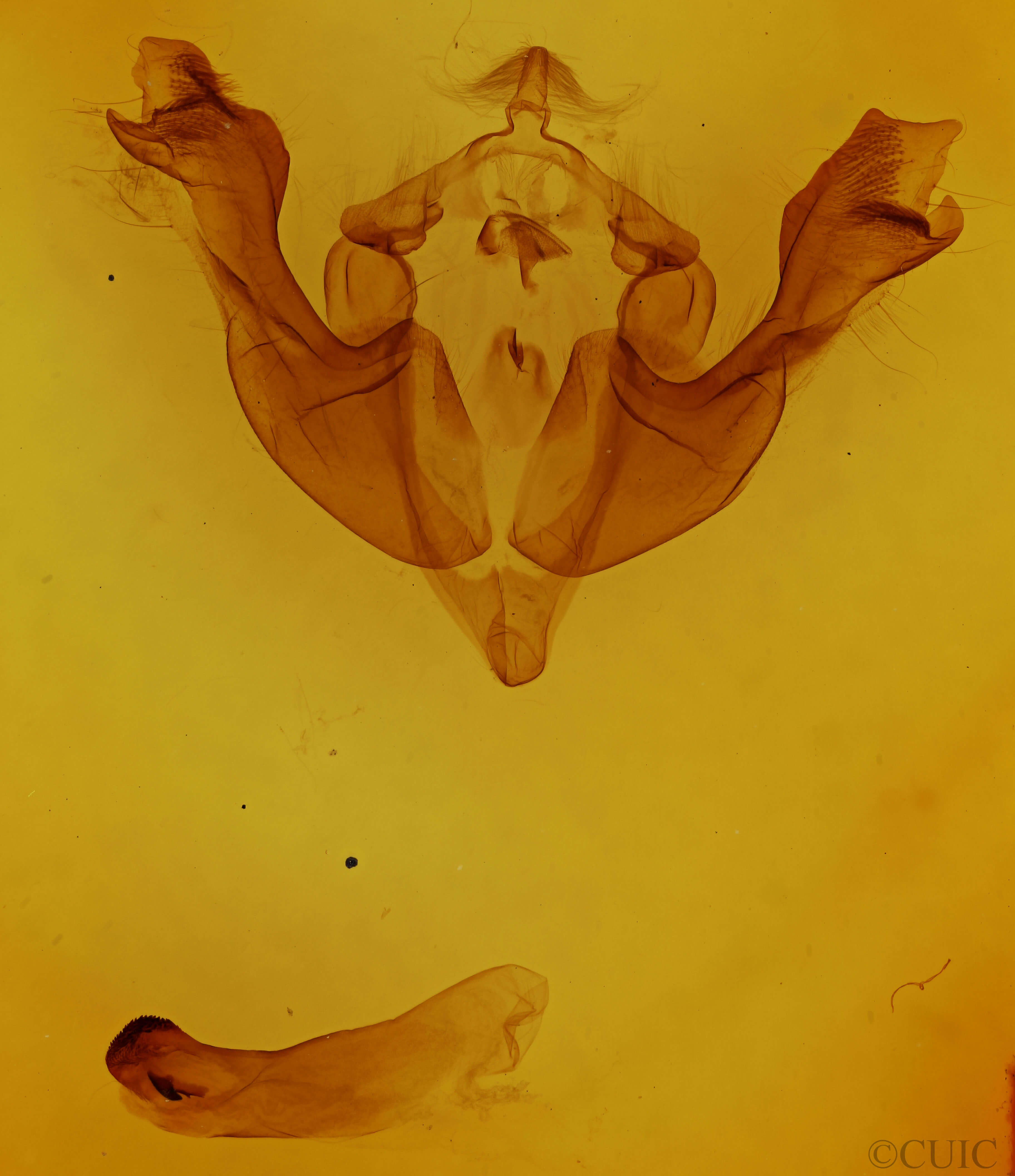 genitalia view of adult Sutyna privata