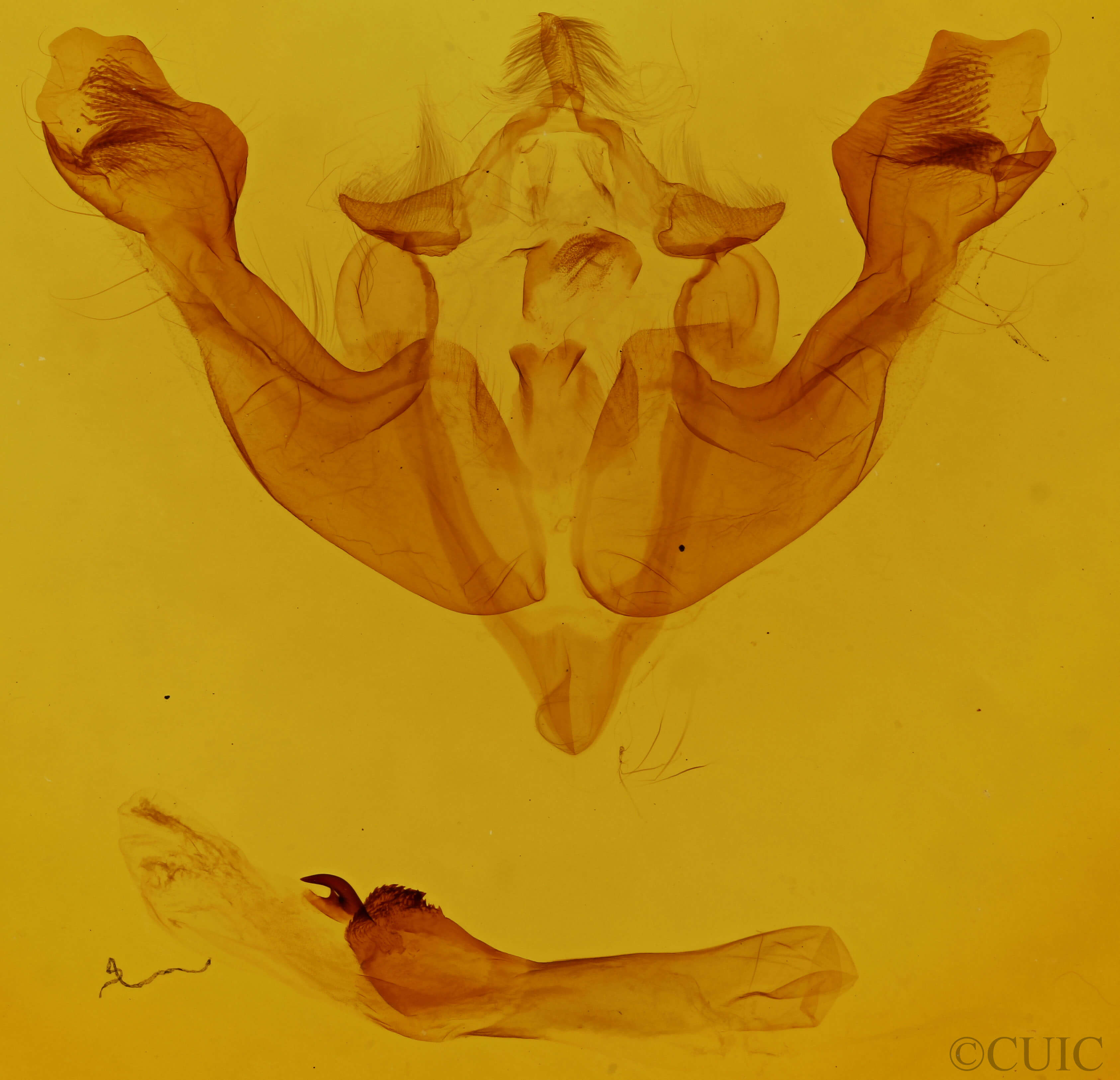 genitalia view of adult Sutyna privata