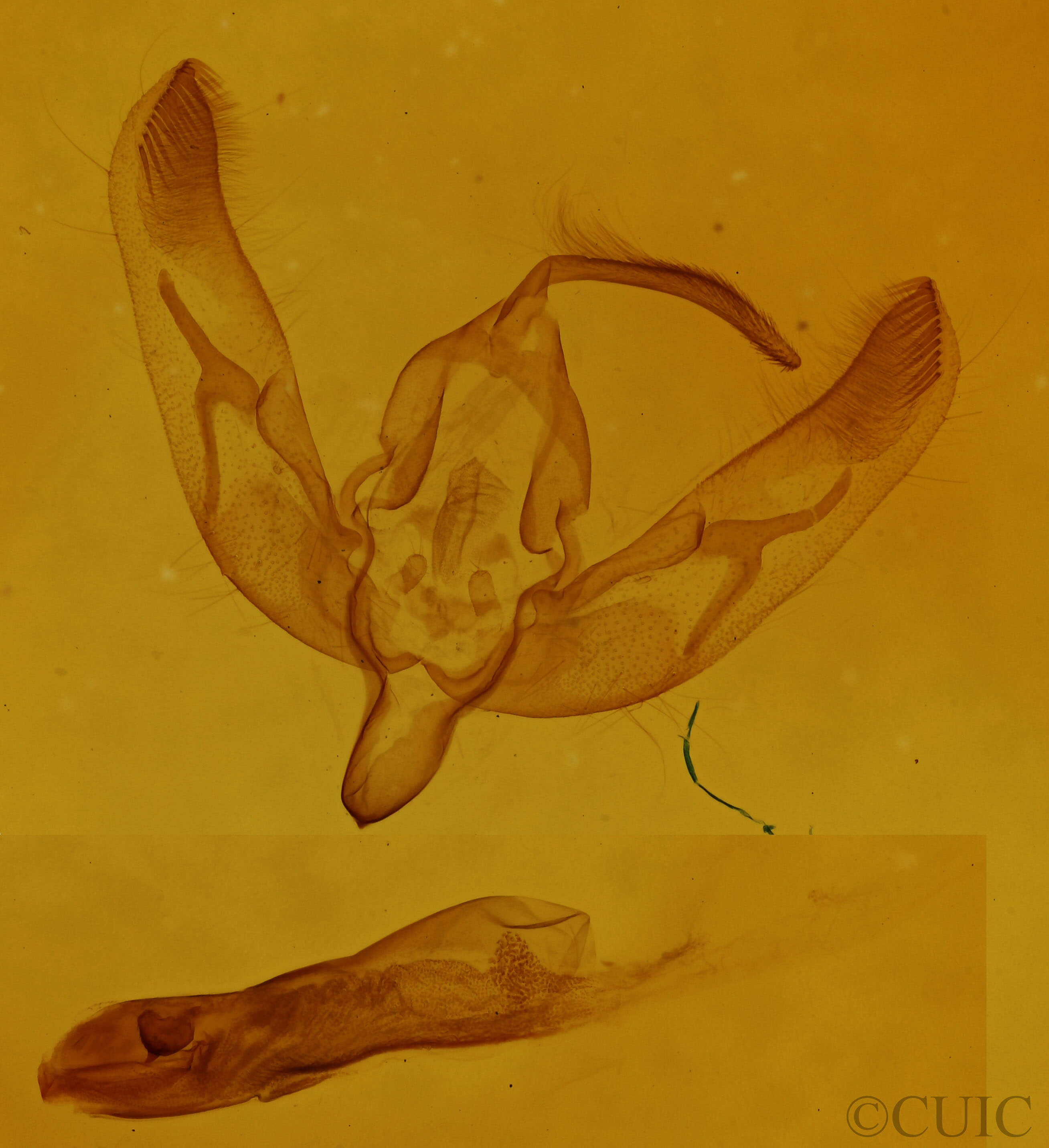 genitalia view of adult Trichosilia geniculata