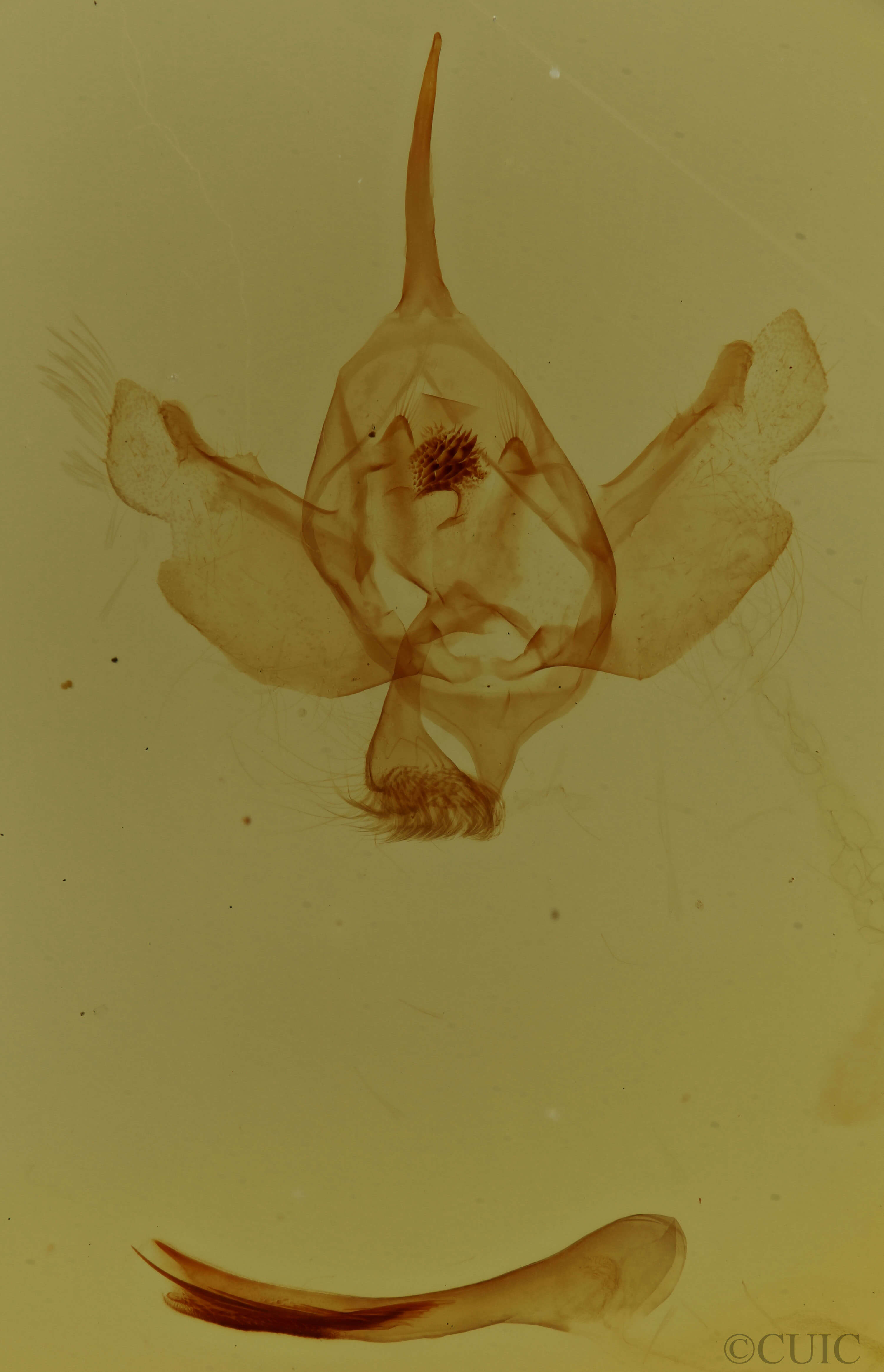 genitalia view of adult  Xanthorhoe gynandrata