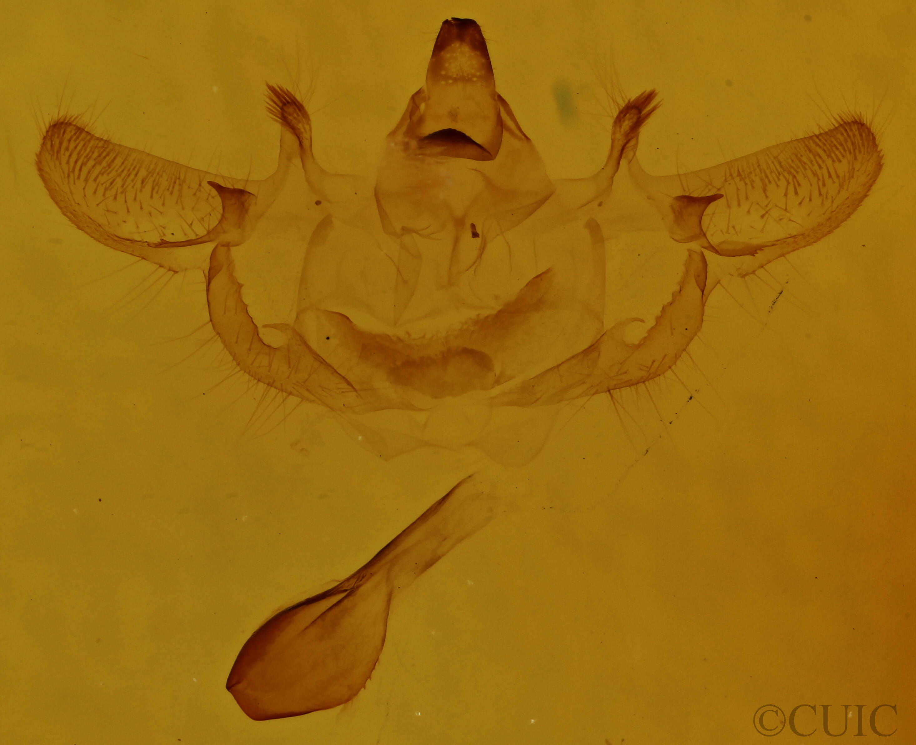 genitalia view of adult Xanthotype sospeta