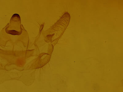 genitalia view of adult Xanthotype urticaria