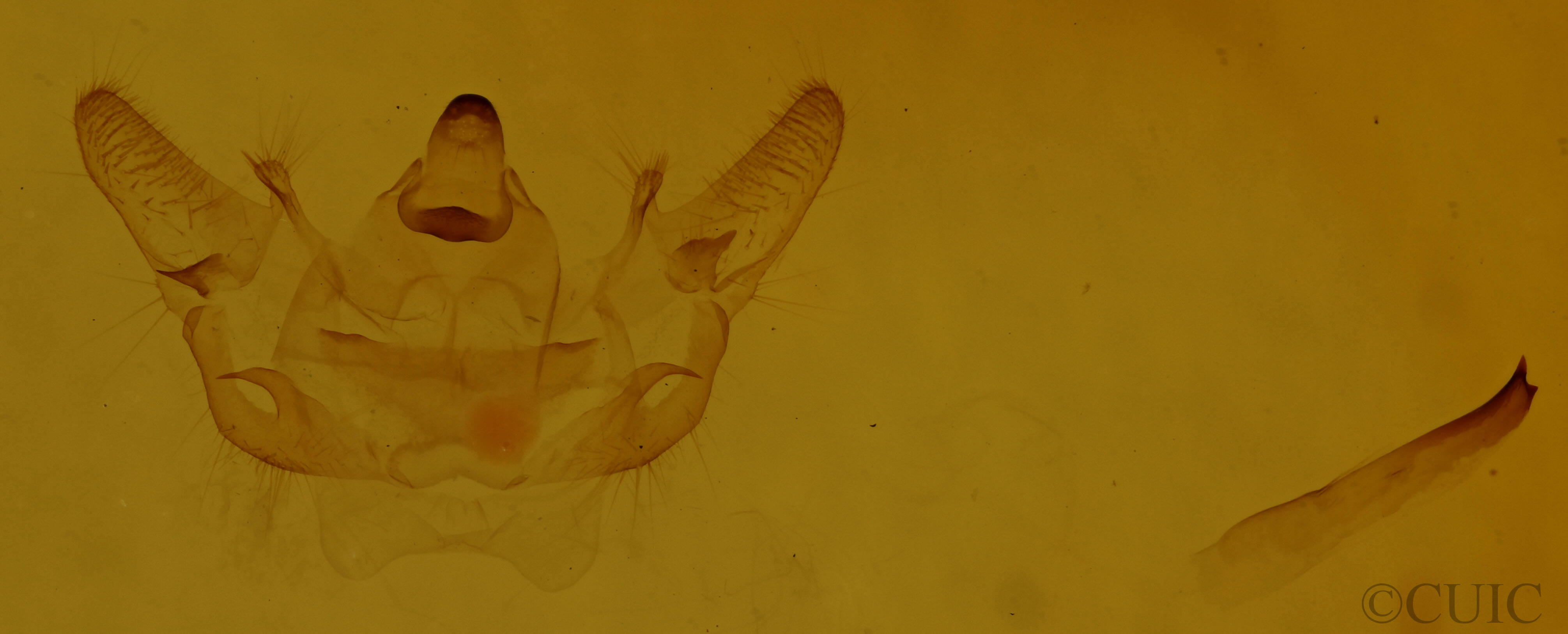 genitalia view of adult Xanthotype urticaria