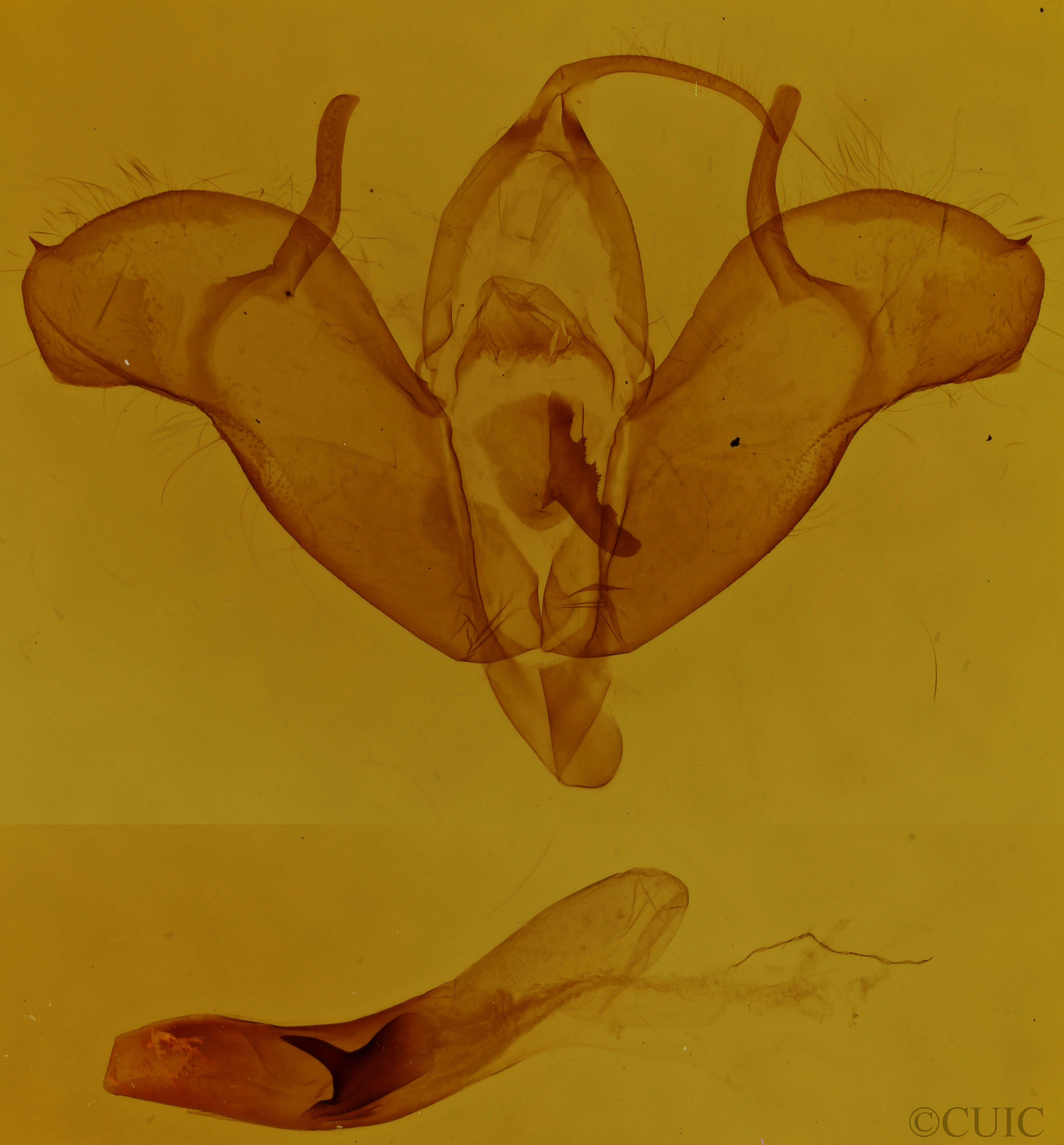 genitalia view of adult Xestia badinodis