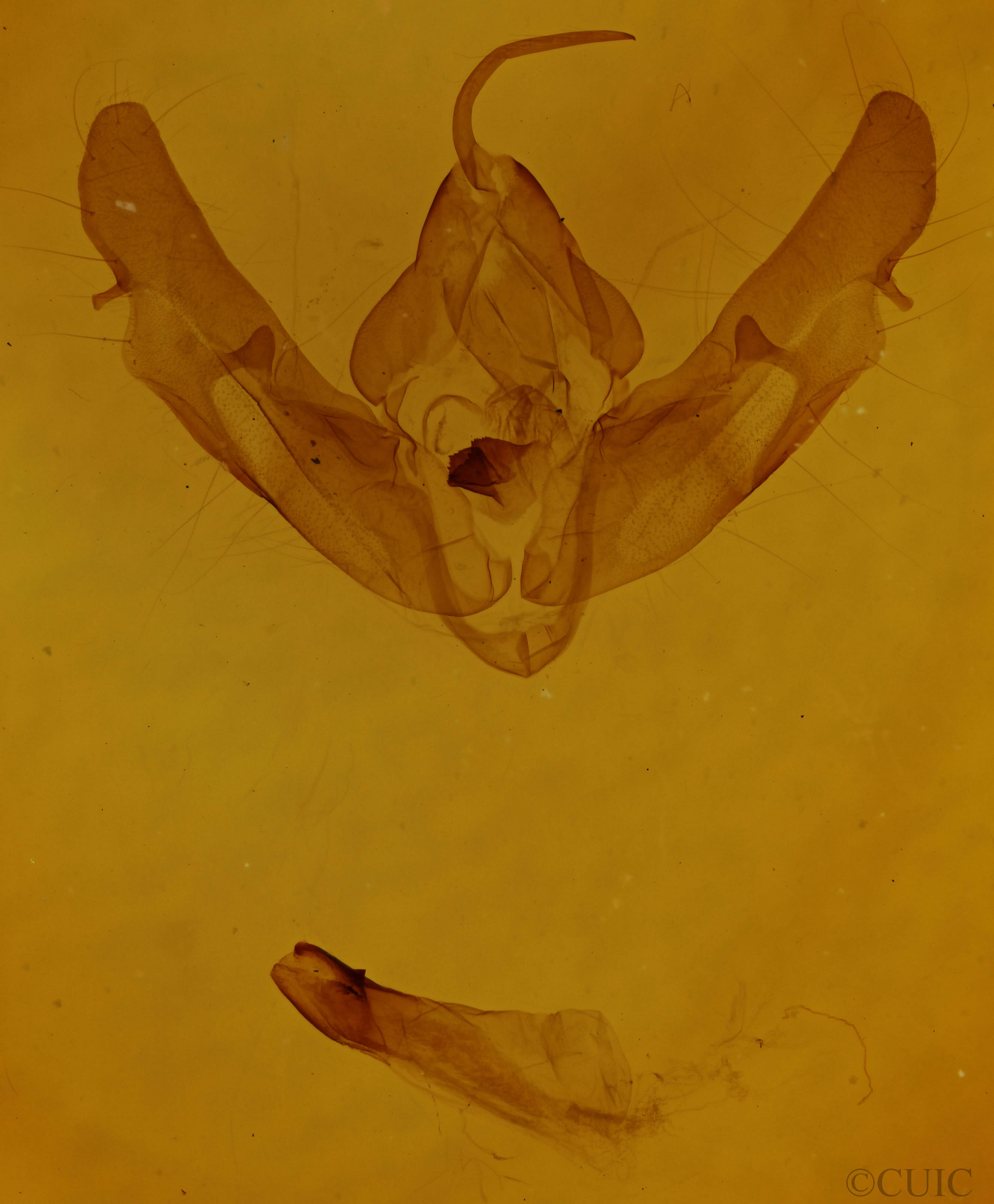 genitalia view of adult Xestia normaniana