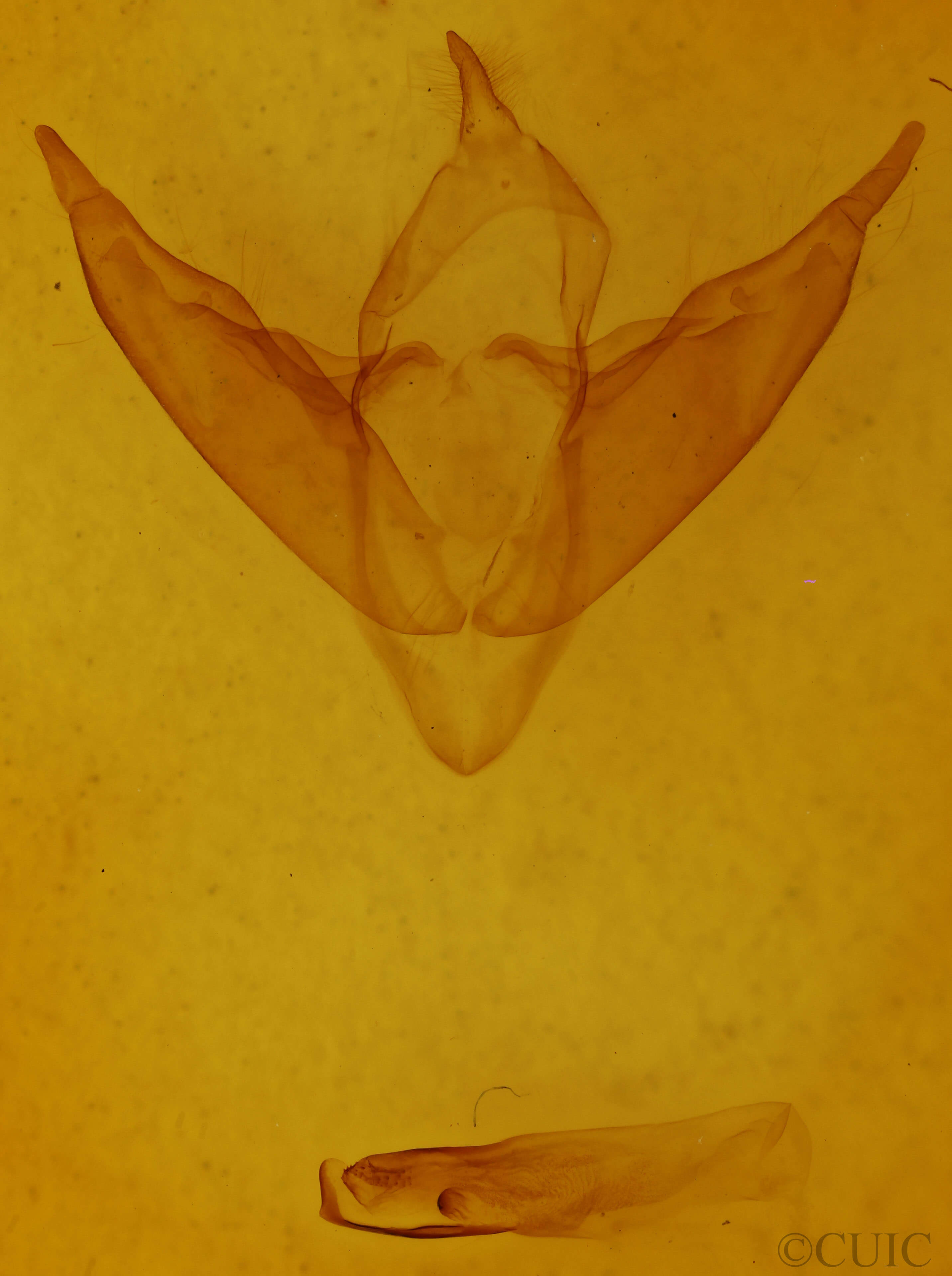 genitalia view of adult Abagrotis alternata