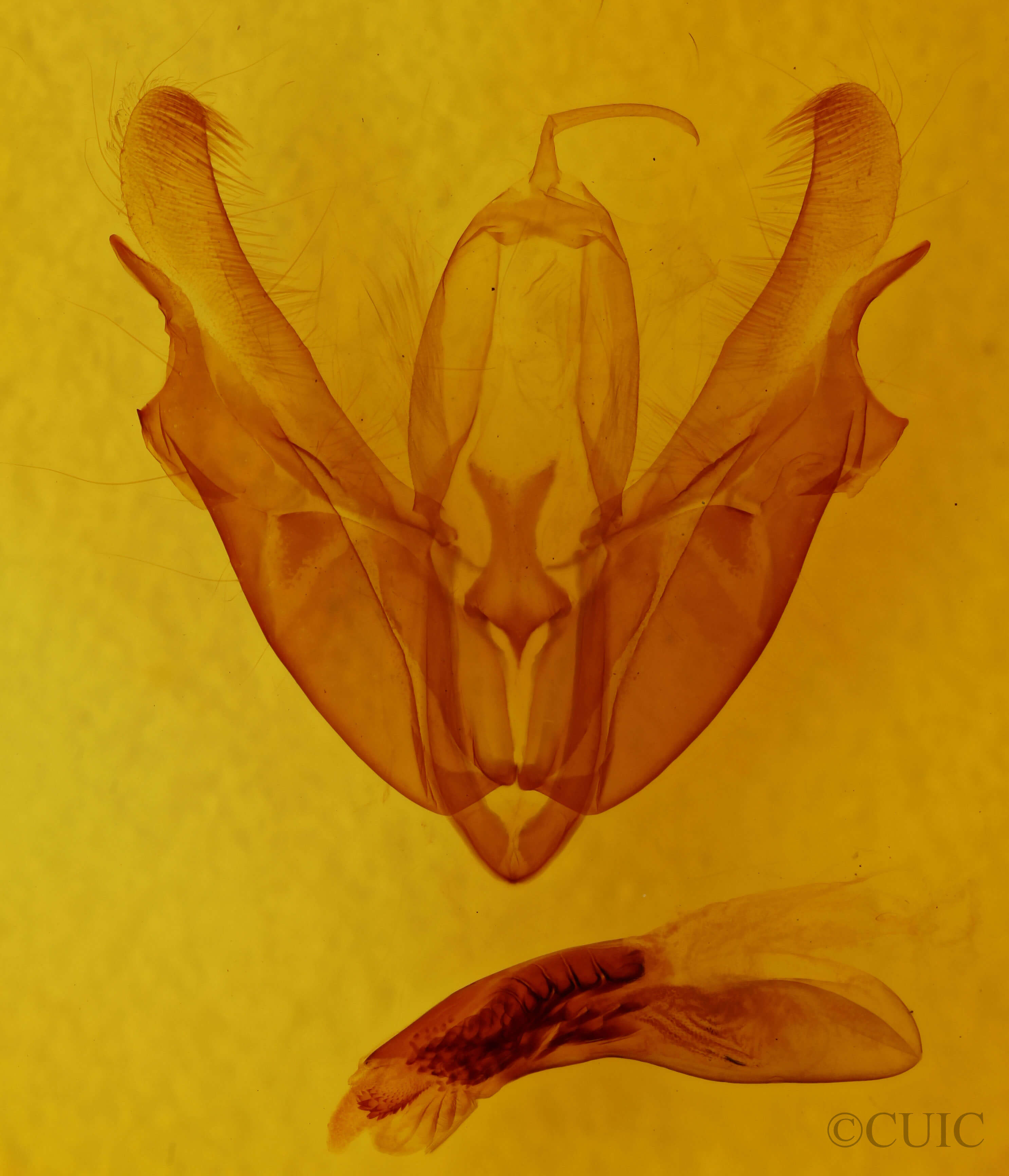 genitalia view of adult Acronicta hastaf