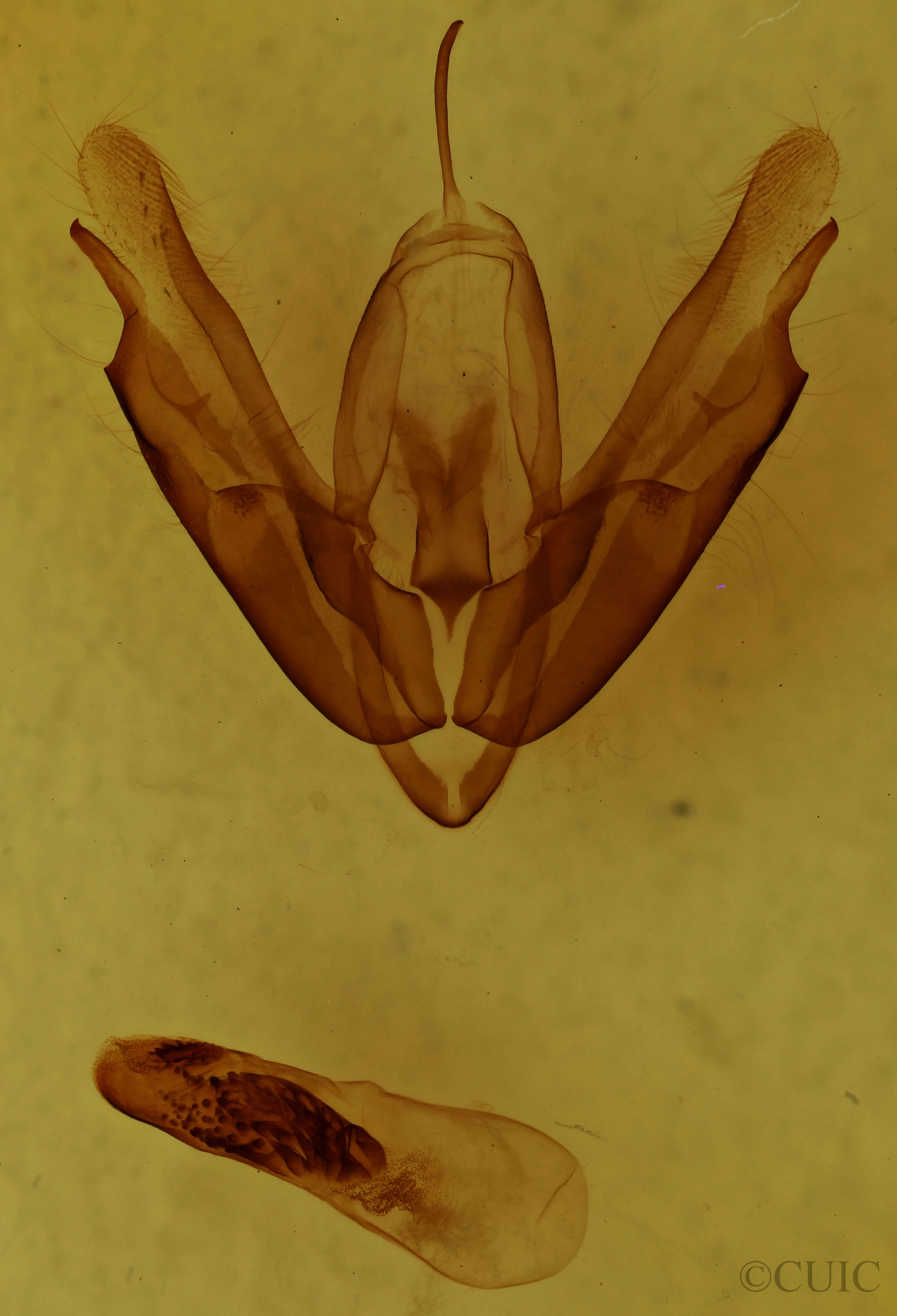 genitalia view of adult Acronicta innotata