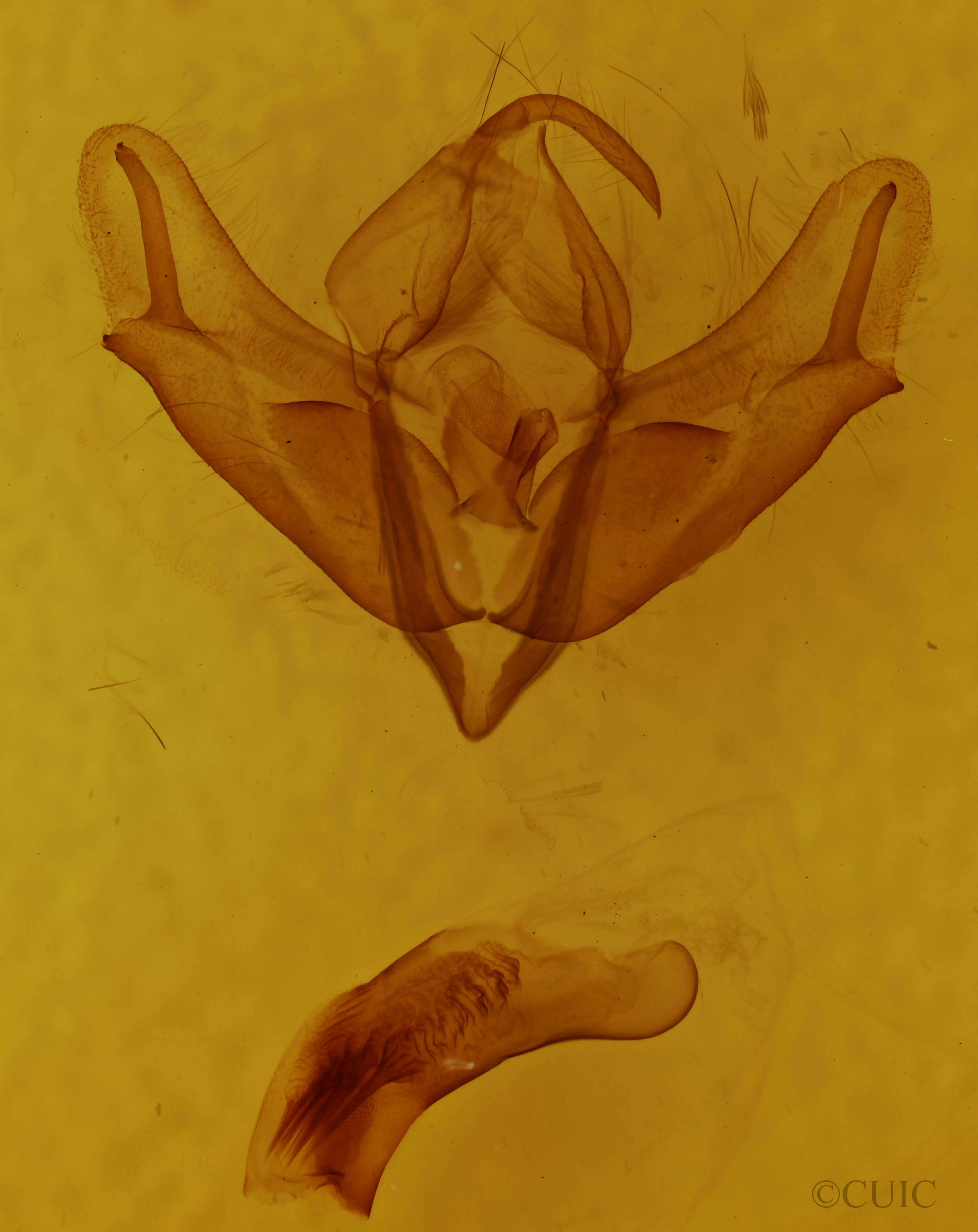 genitalia view of adult Acronicta longa