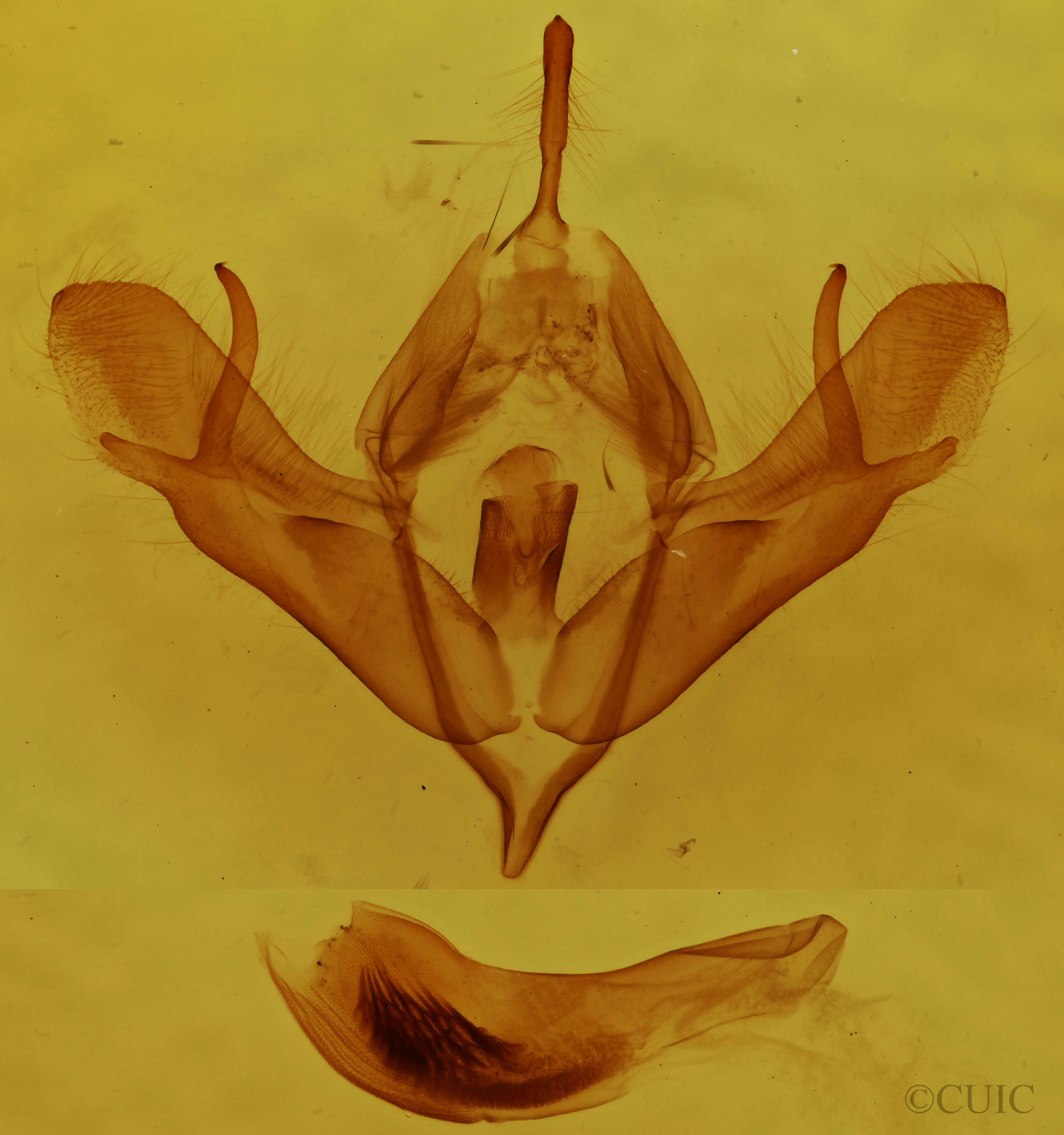 genitalia view of adult Acronicta oblinita