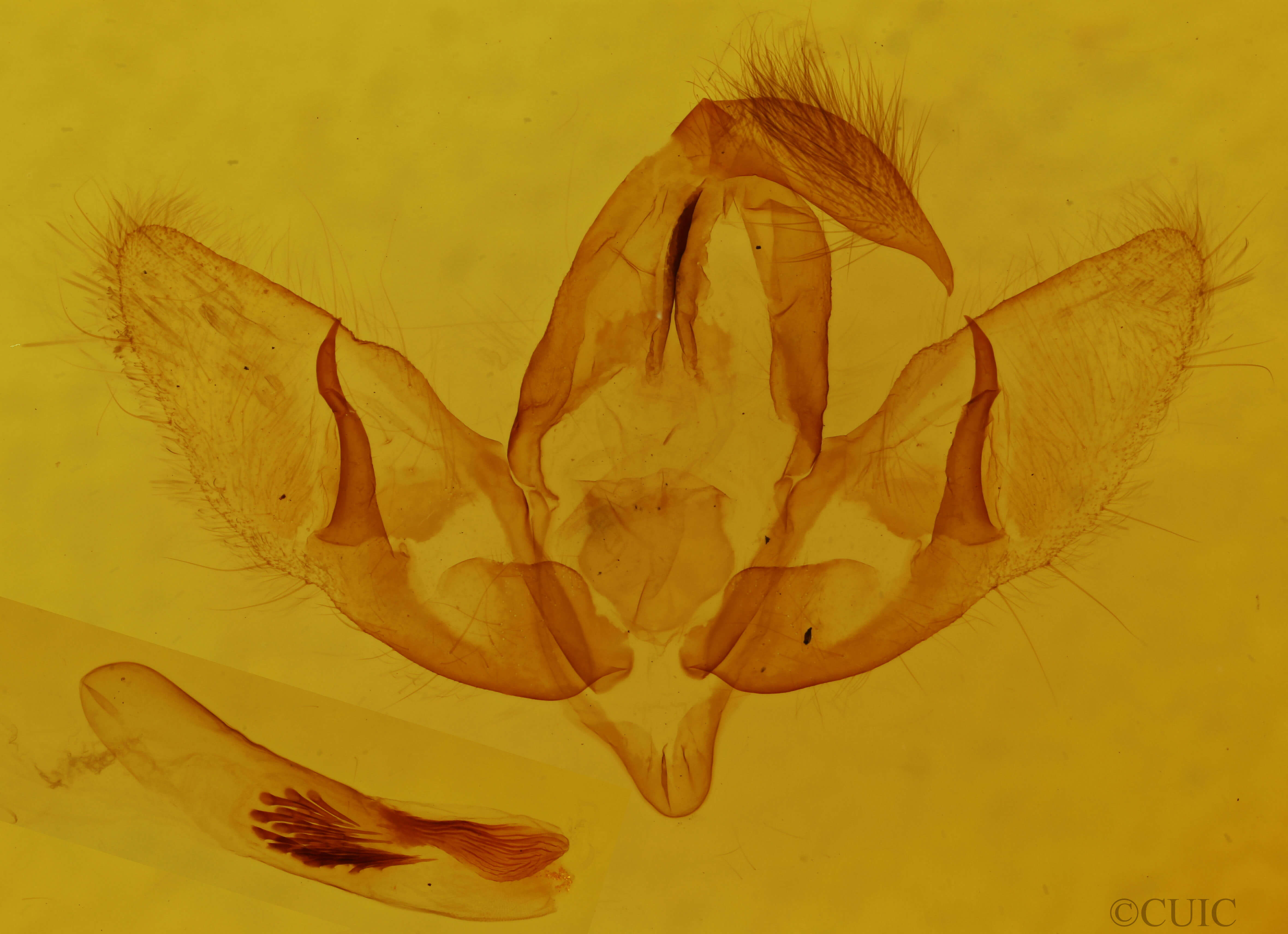 genitalia view of adult Acronicta lepusculina