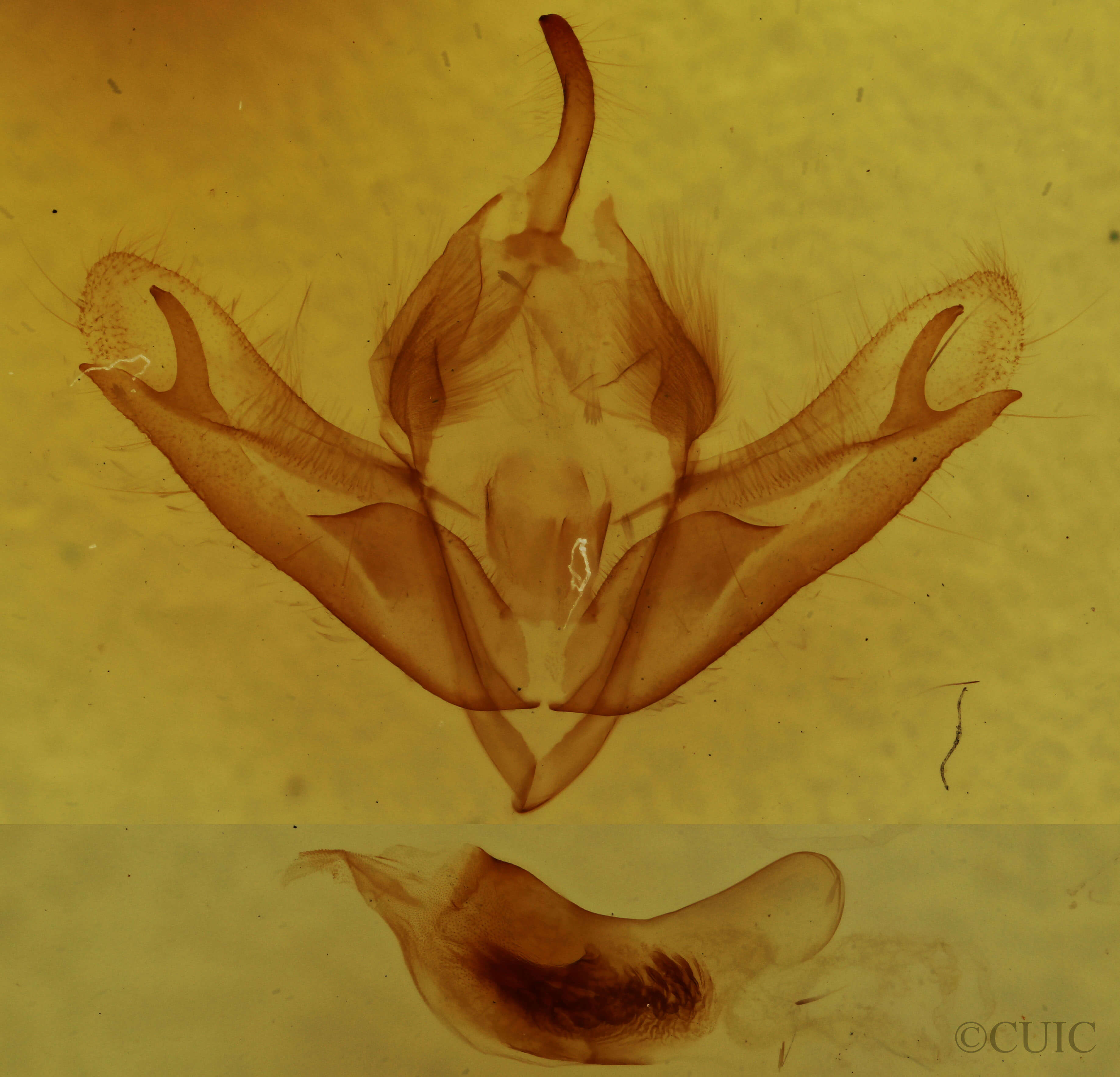 genitalia view of adult Acronicta sperata