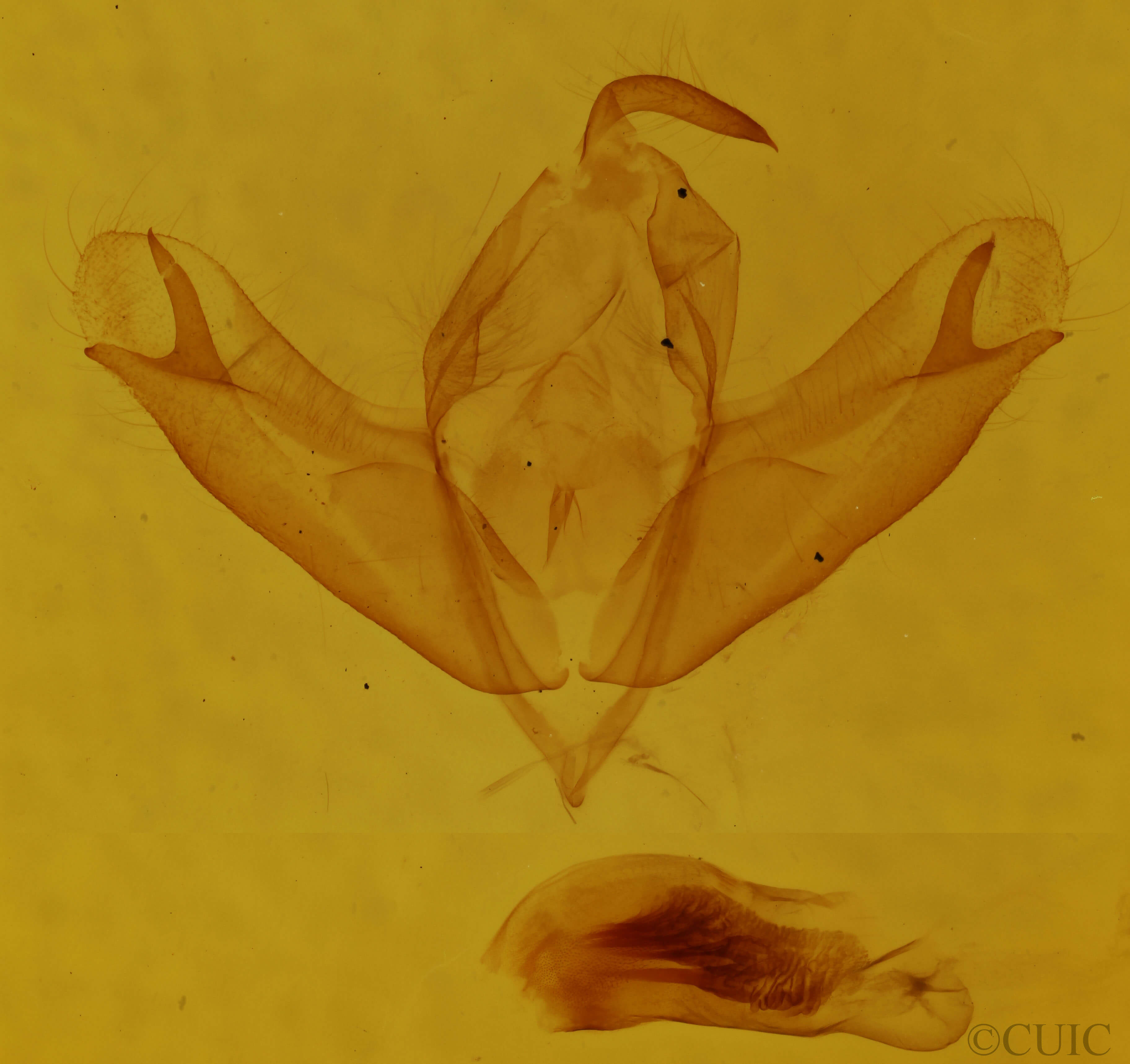 genitalia view of adult Acronicta sperata