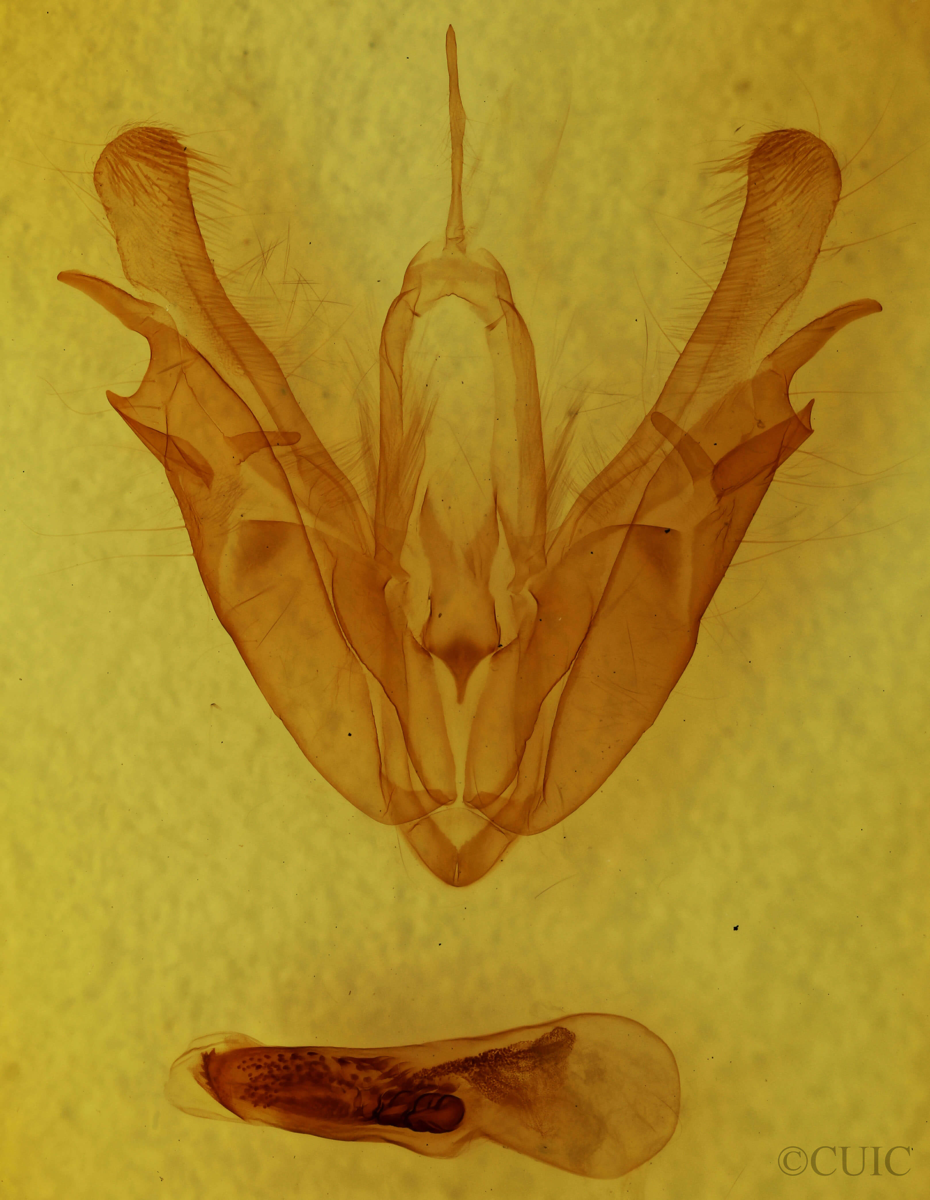 genitalia view of adult Acronicta superans