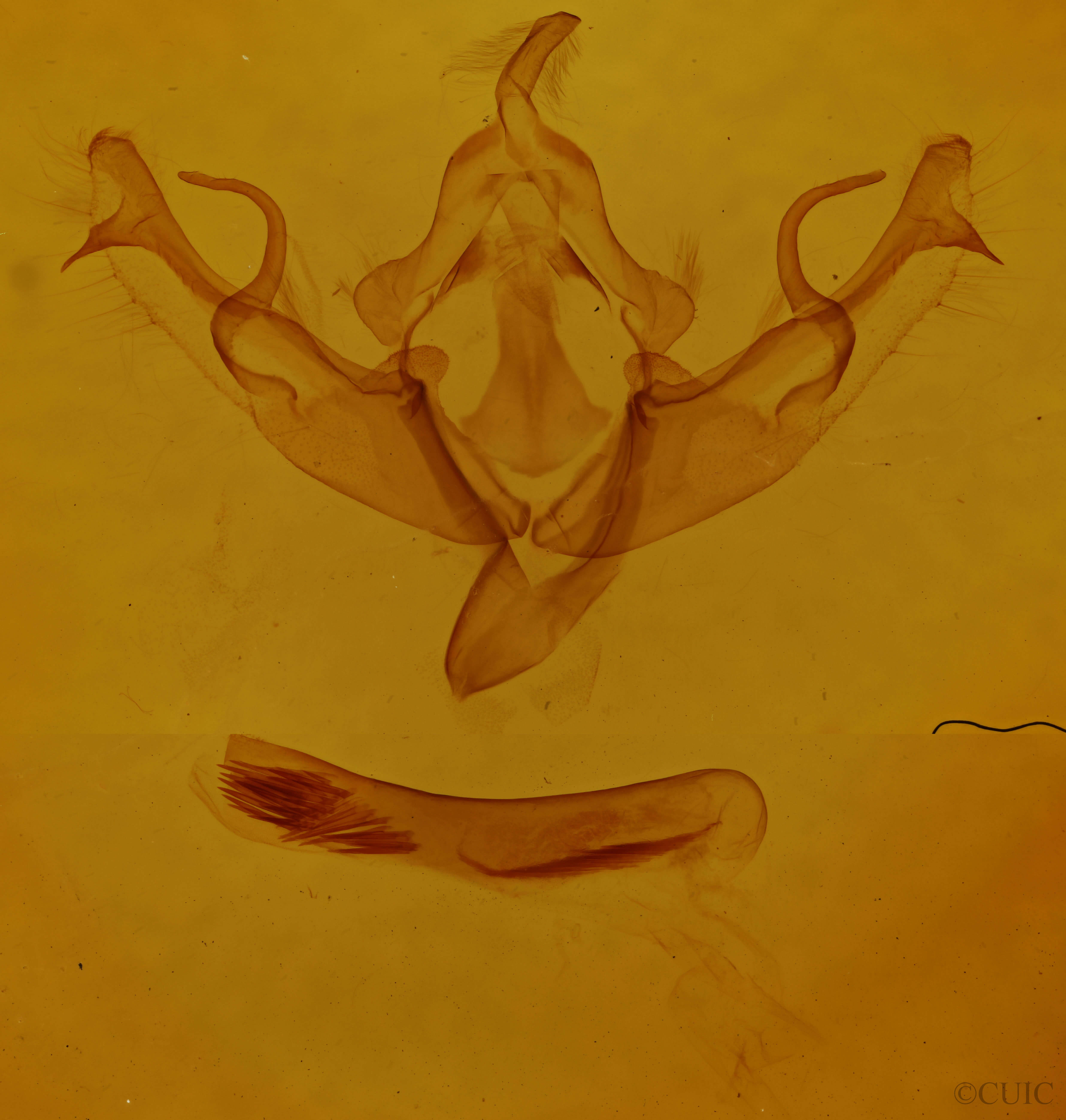 genitalia view of adult Agrochola pulchella
