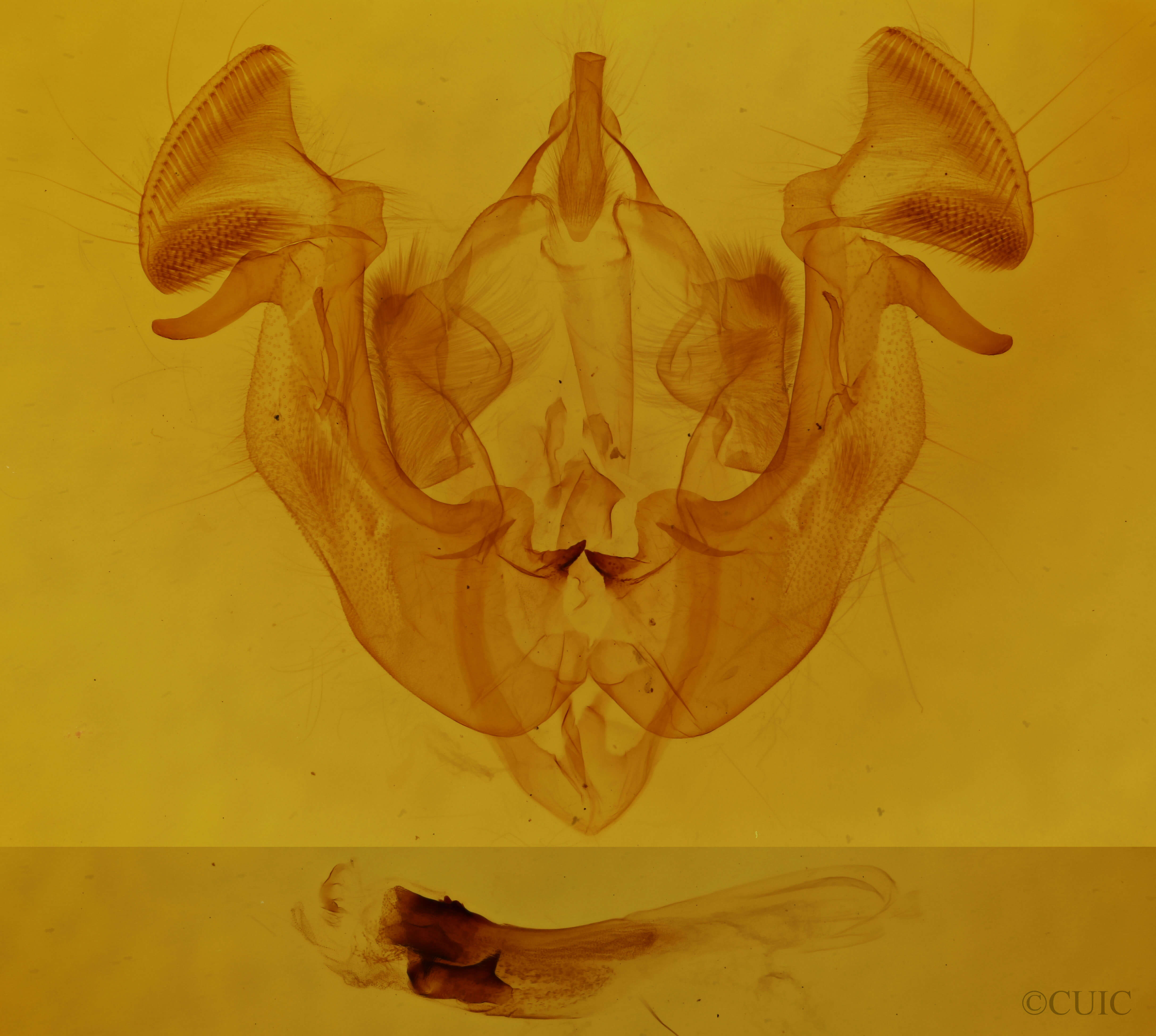 genitalia view of adult Apamea sordens finitima