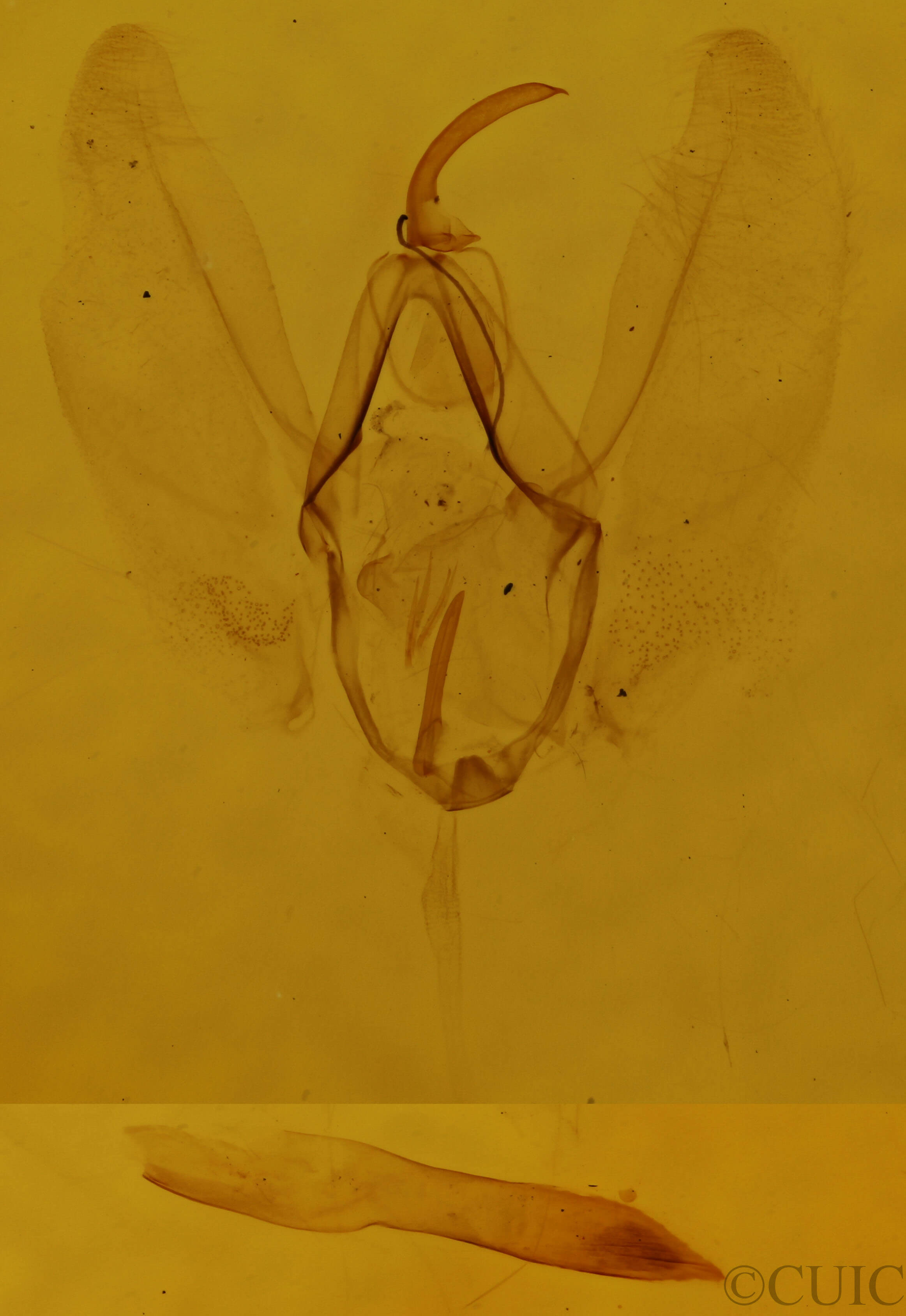 genitalia view of adult Lomographa glomeraria