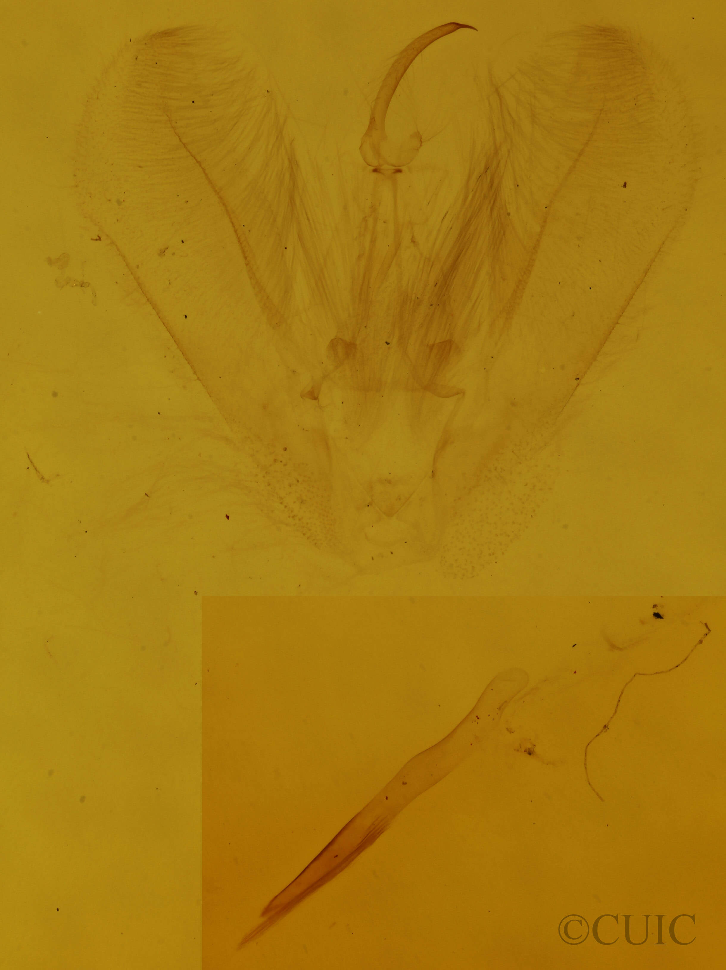 genitalia view of adult Lomographa vestaliata