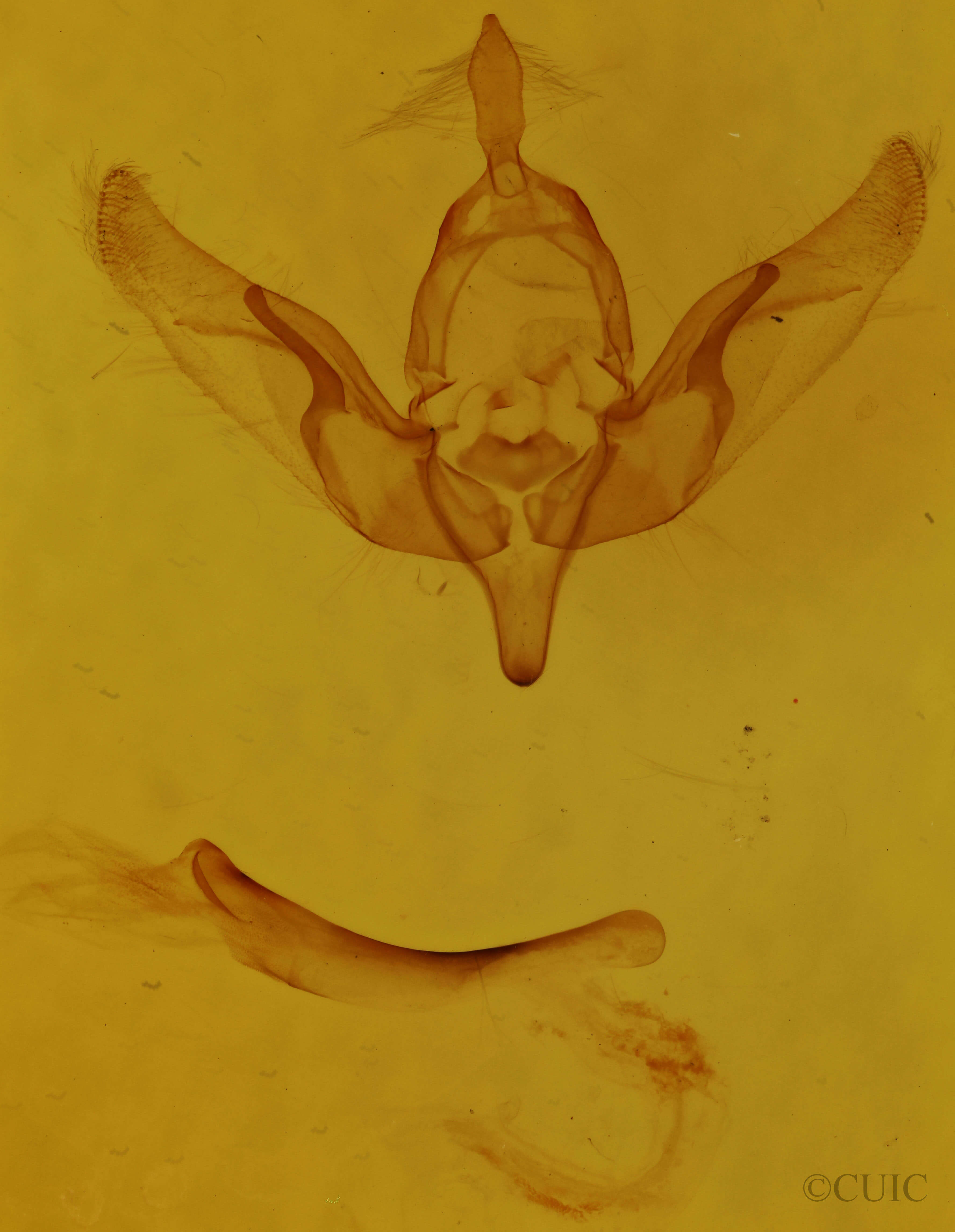 genitalia view of adult Brachylomia curvifascia