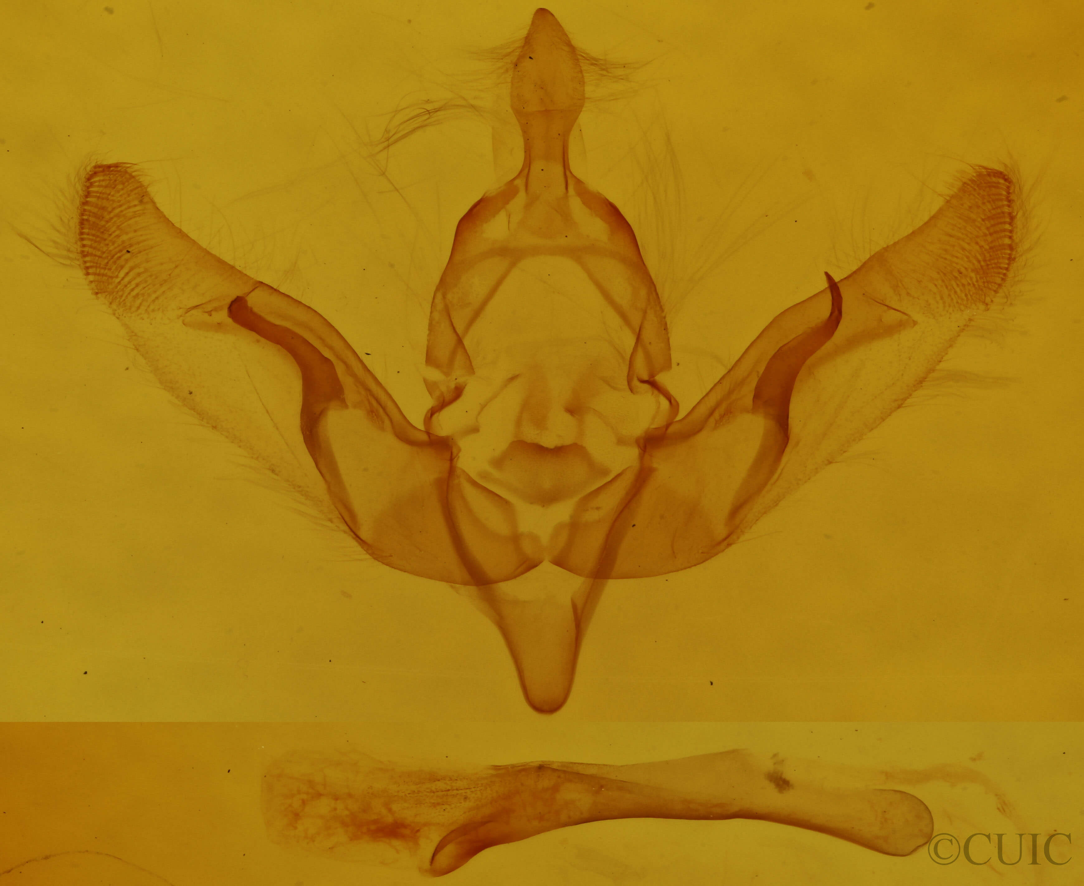 genitalia view of adult Brachylomia curvifascia