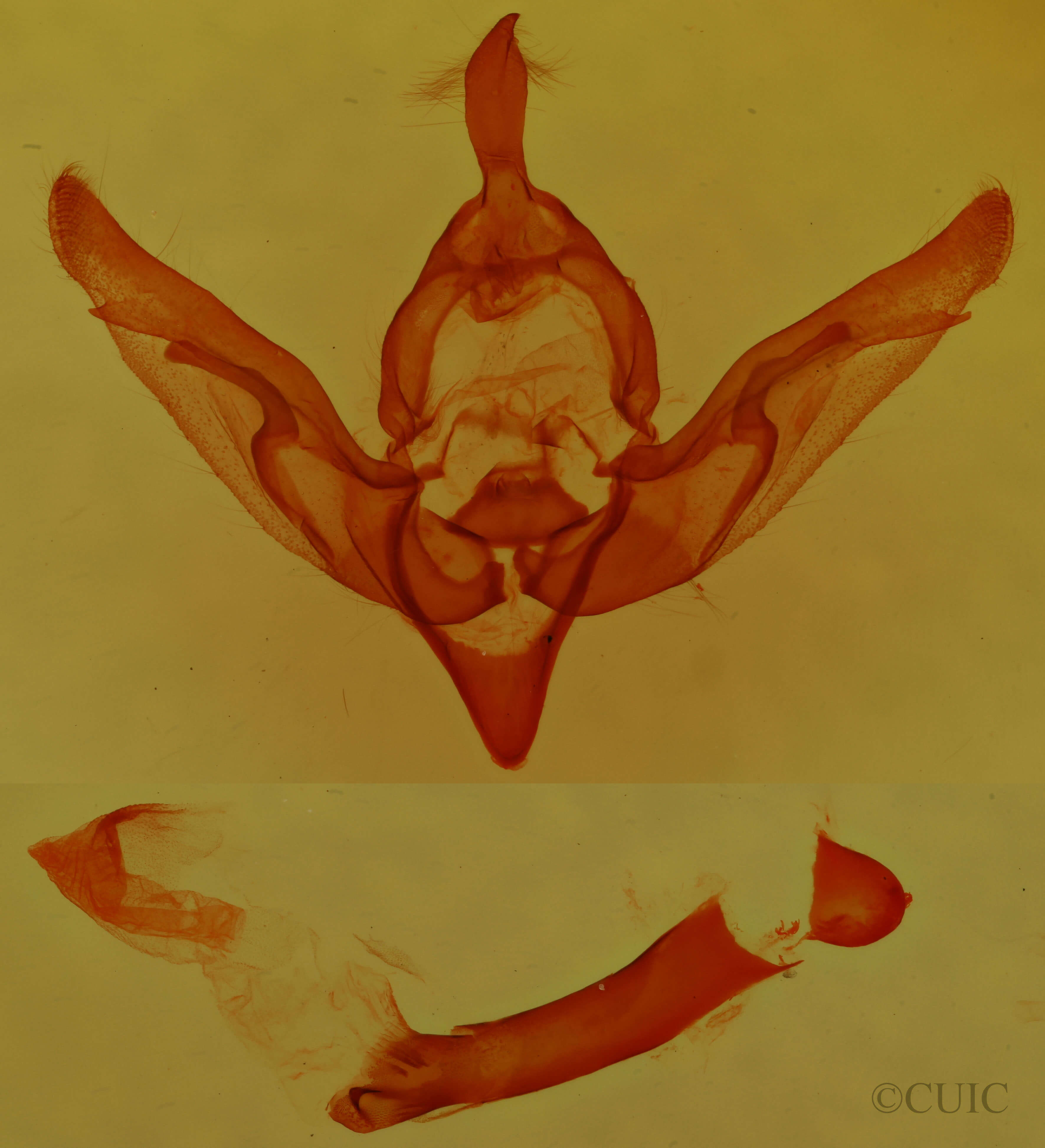 genitalia view of adult Brachylomia rectifascia