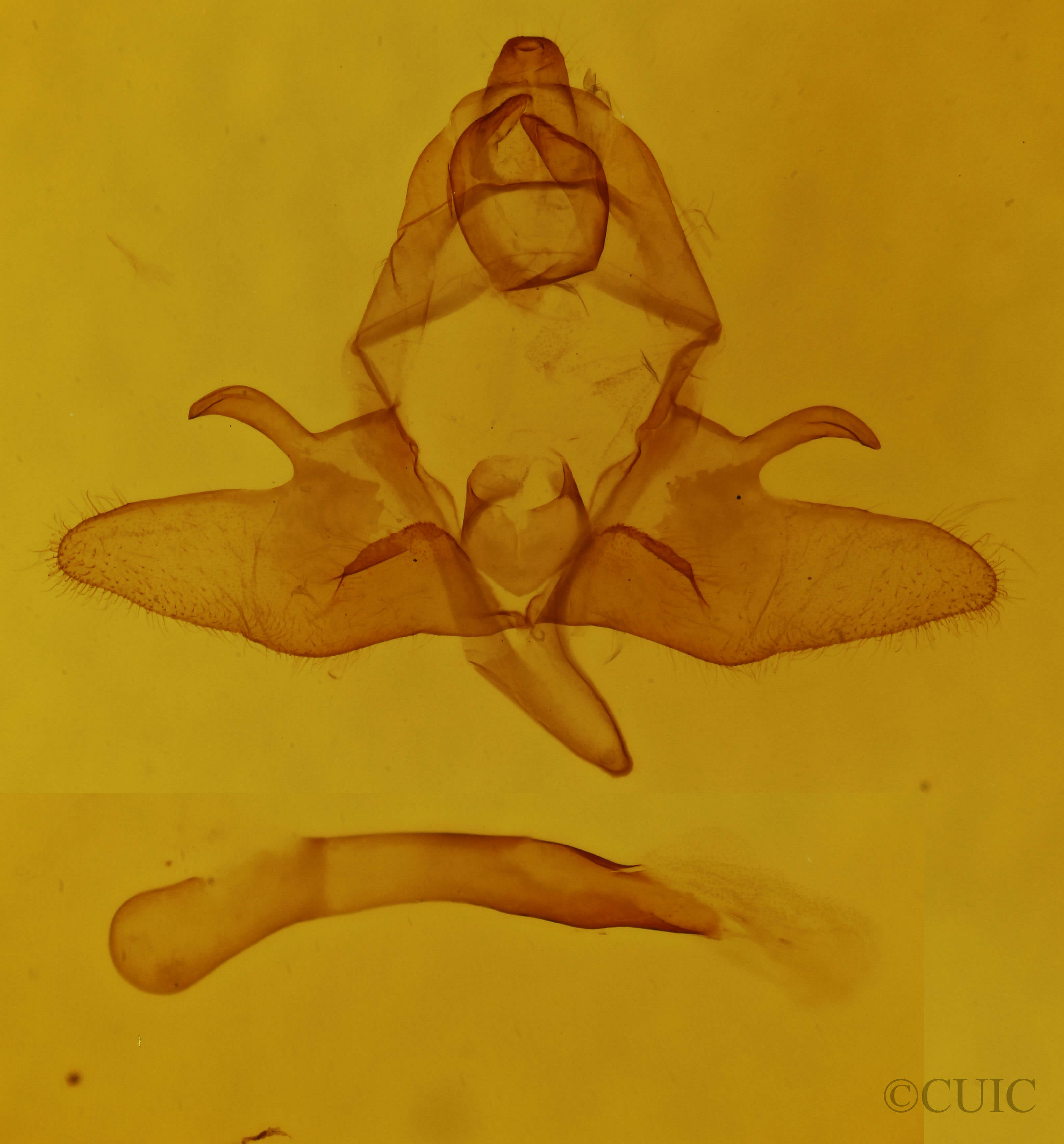 genitalia view of adult Dasychira plagiata