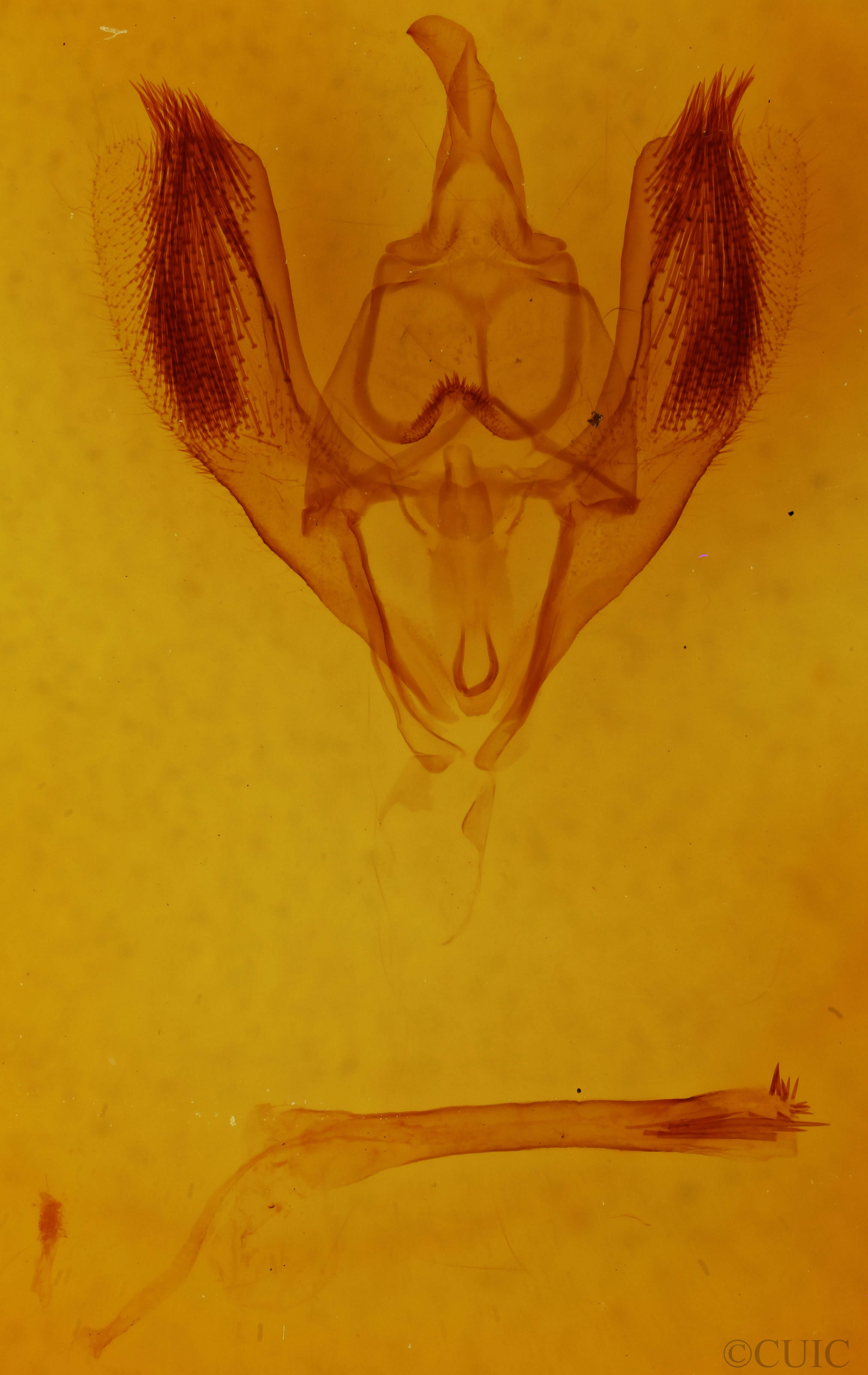 genitalia view of adult Ennomos magnaria