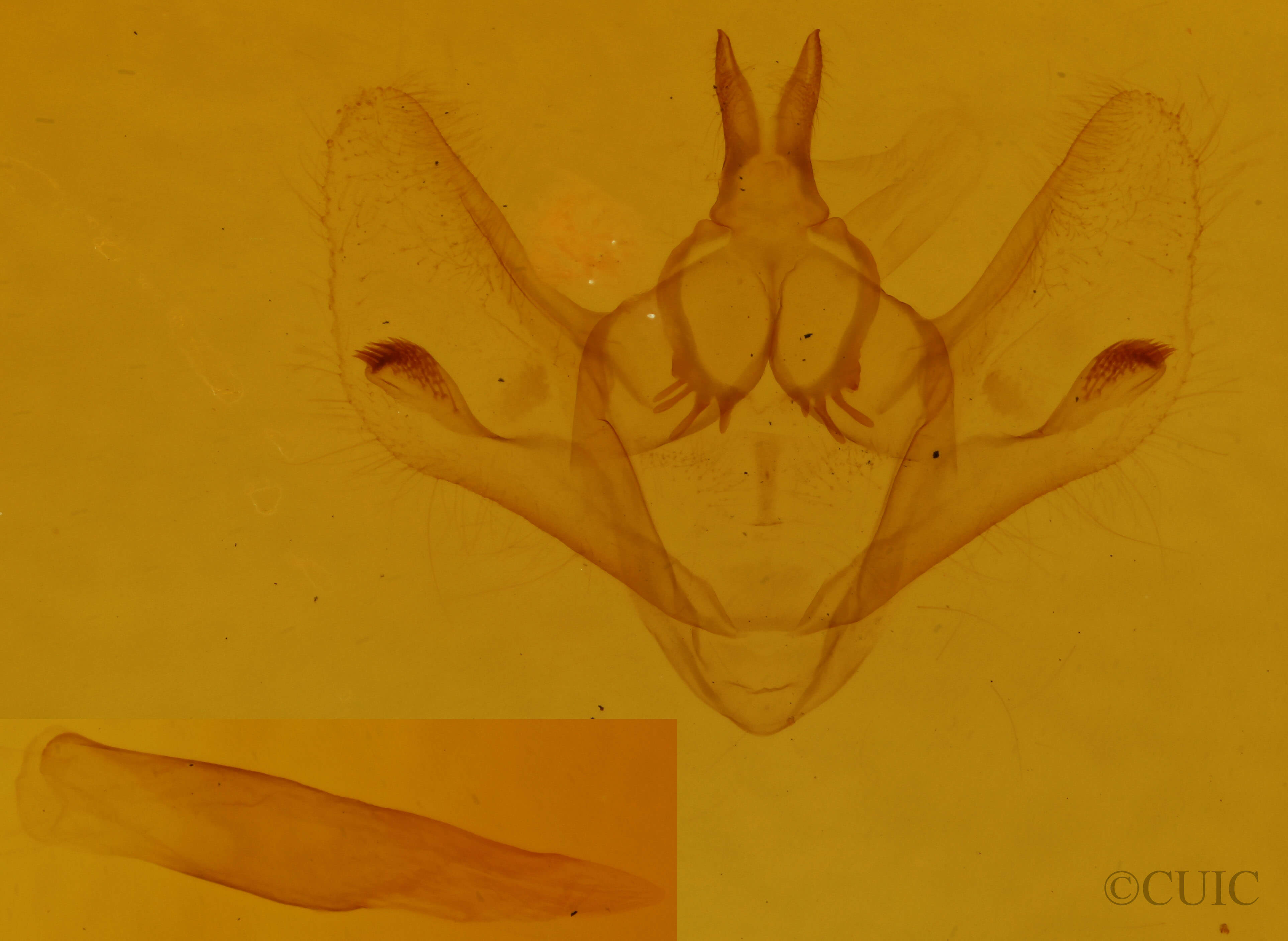 genitalia view of adult Epimecis hortaria