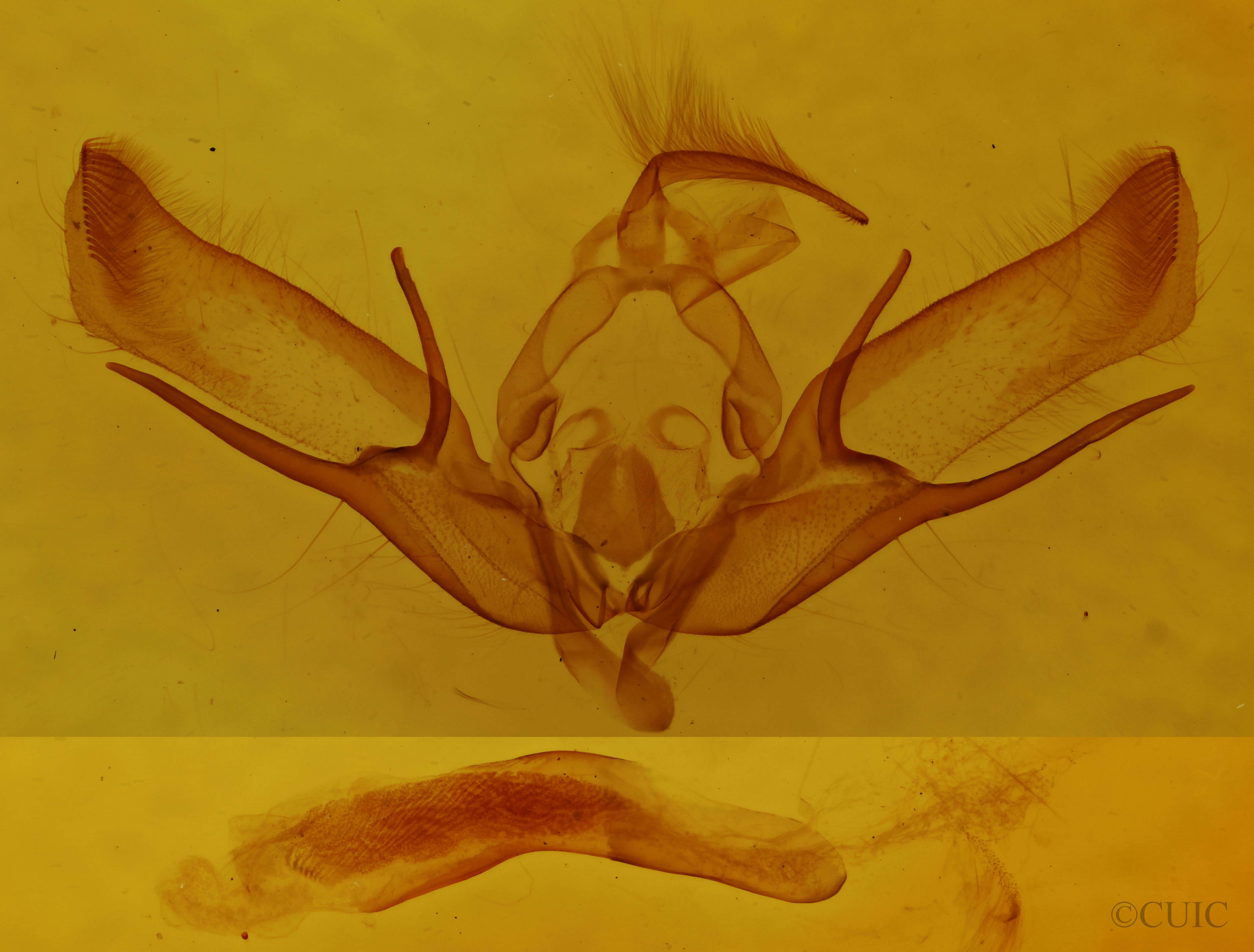 genitalia view of adult Euxoa tessellata