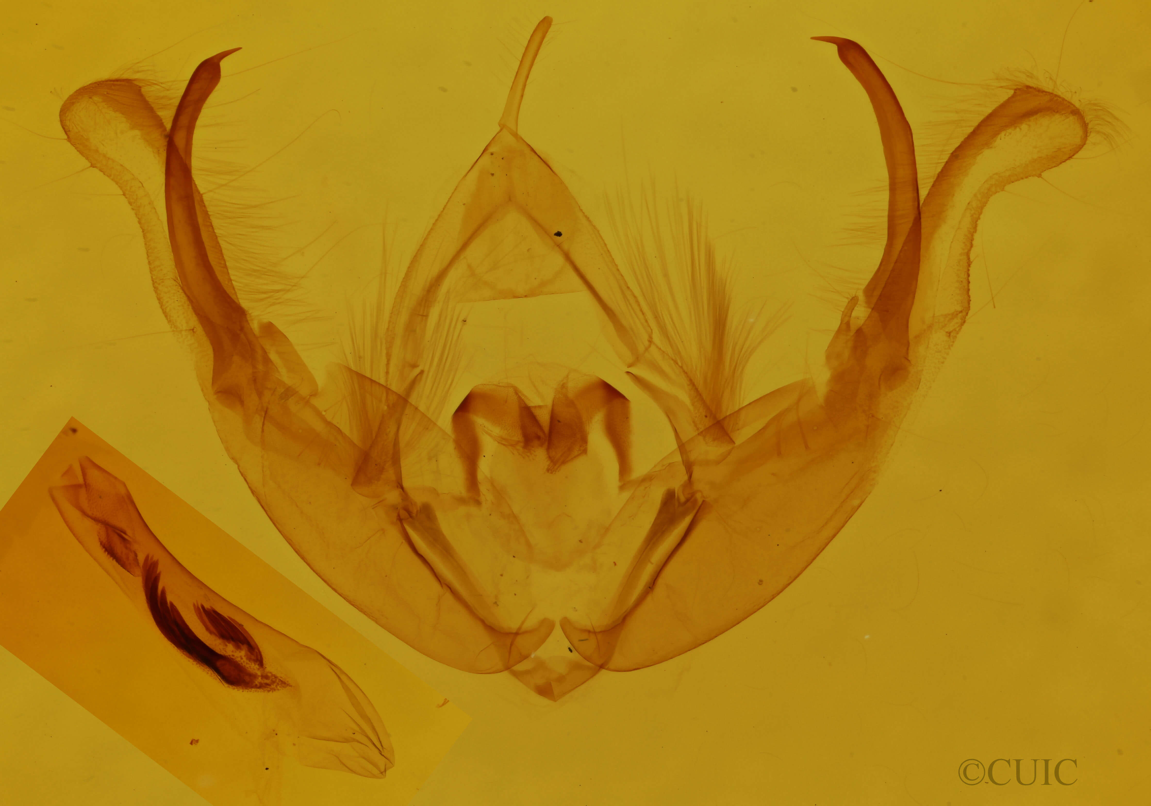 genitalia view of adult Orthimella fidelis