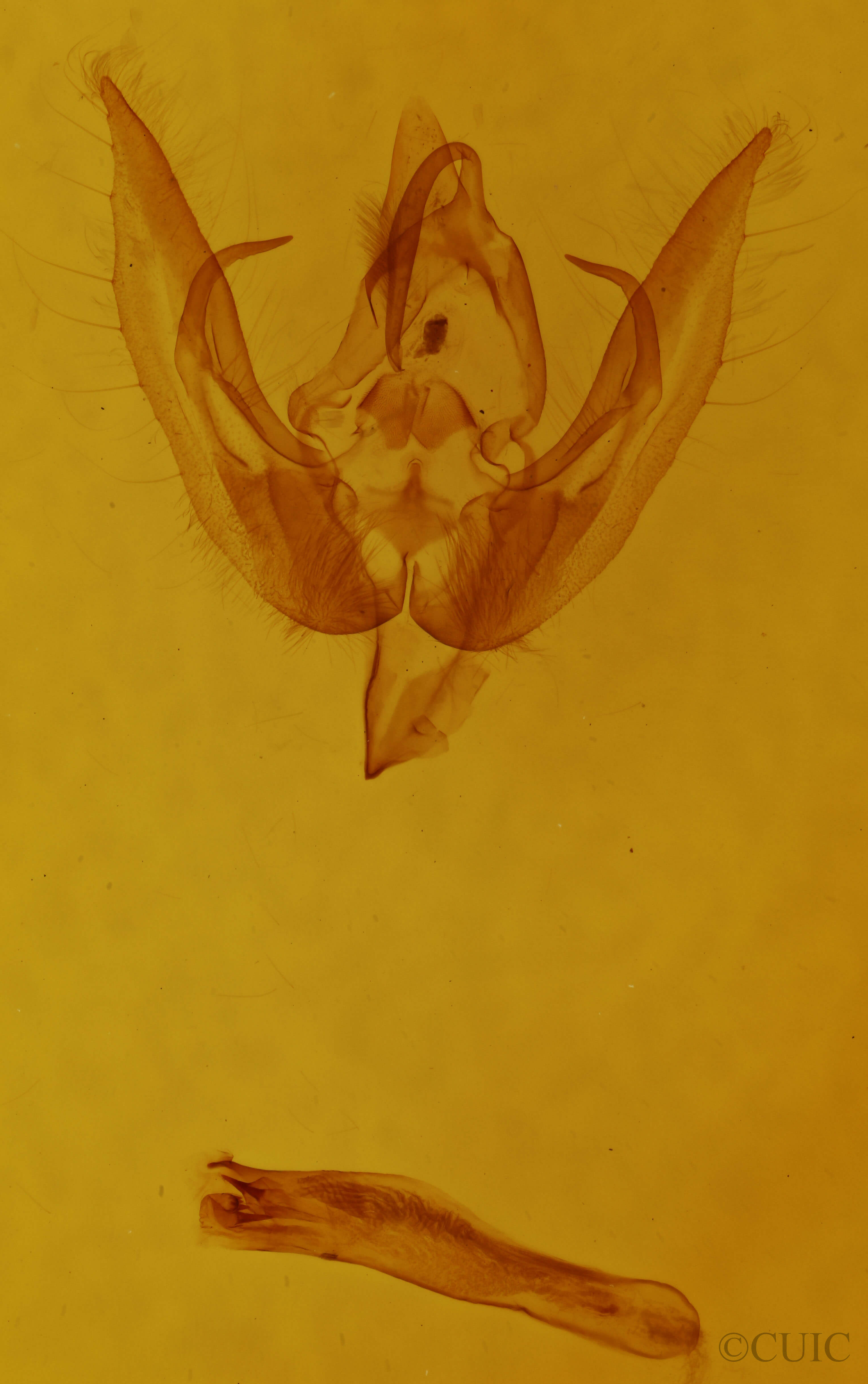 genitalia view of adult Homoanarta falcata