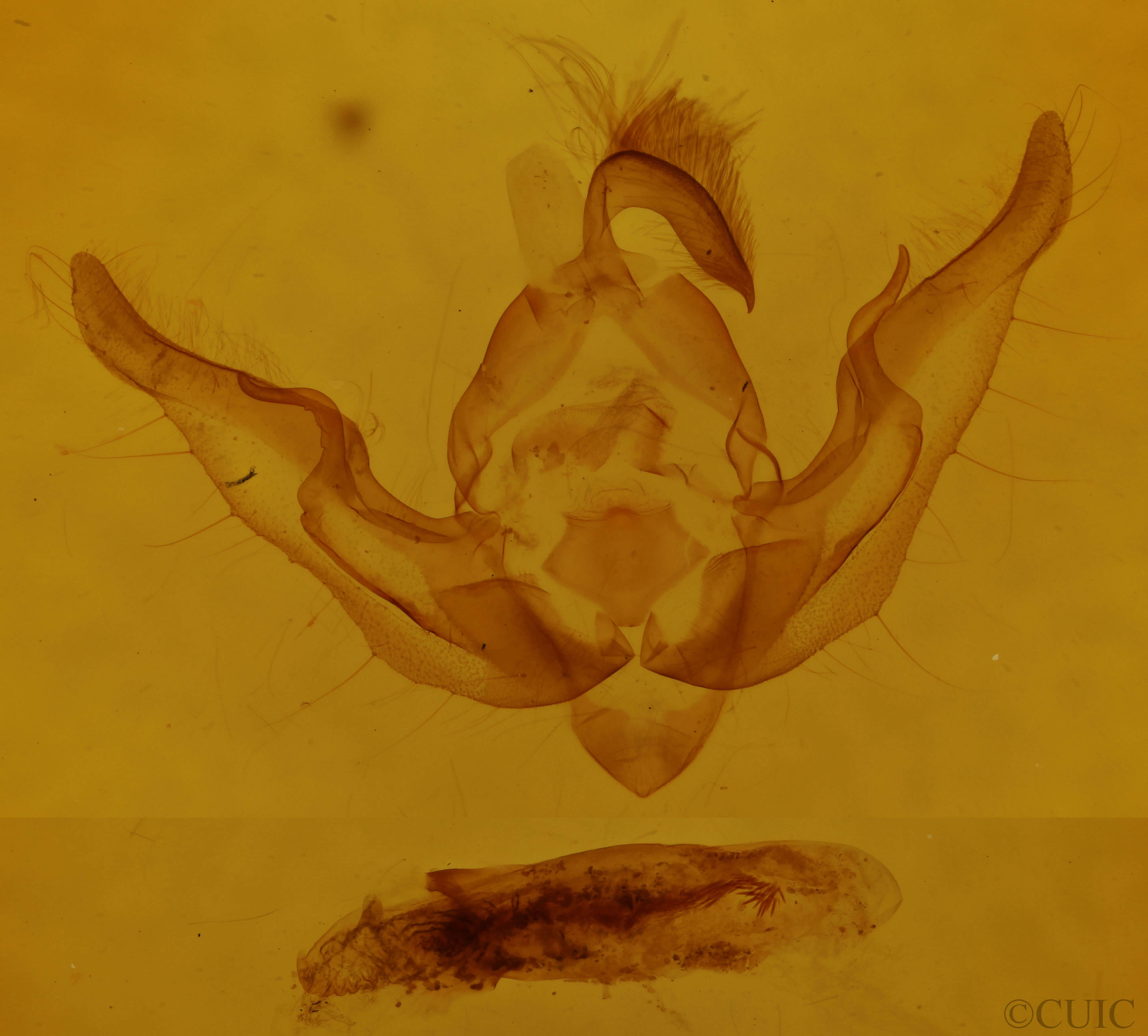 genitalia view of adult Homoanarta peralta