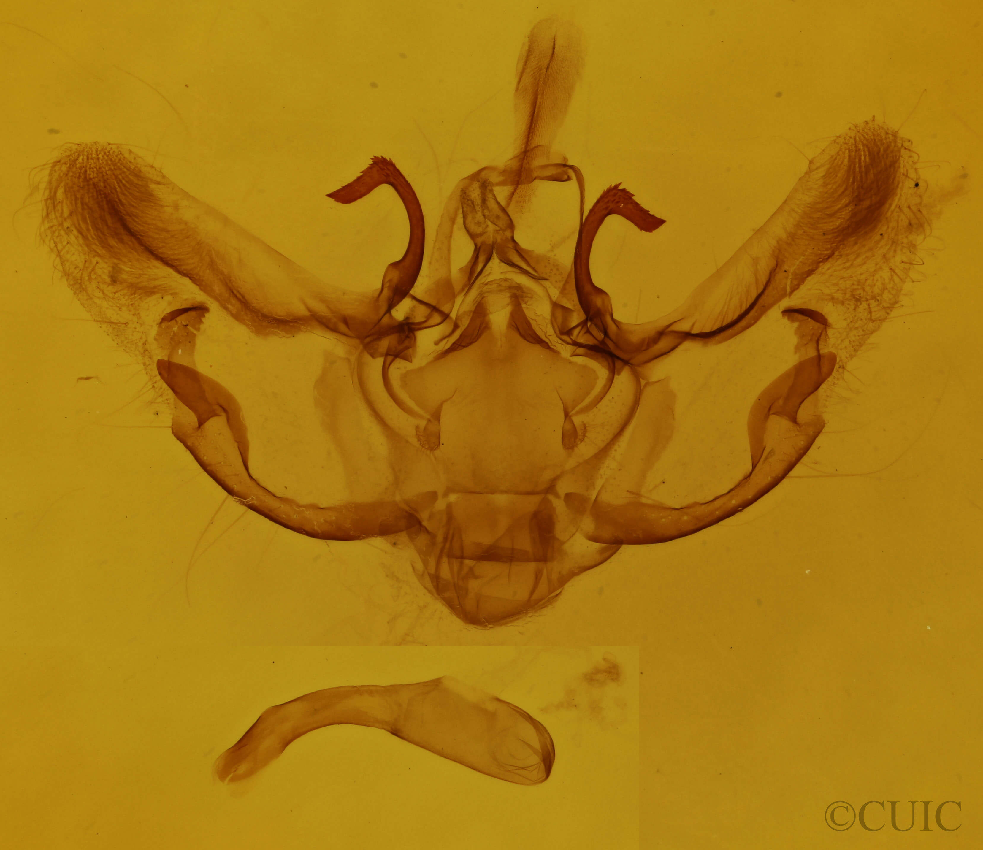 genitalia view of adult Horisme intestinata