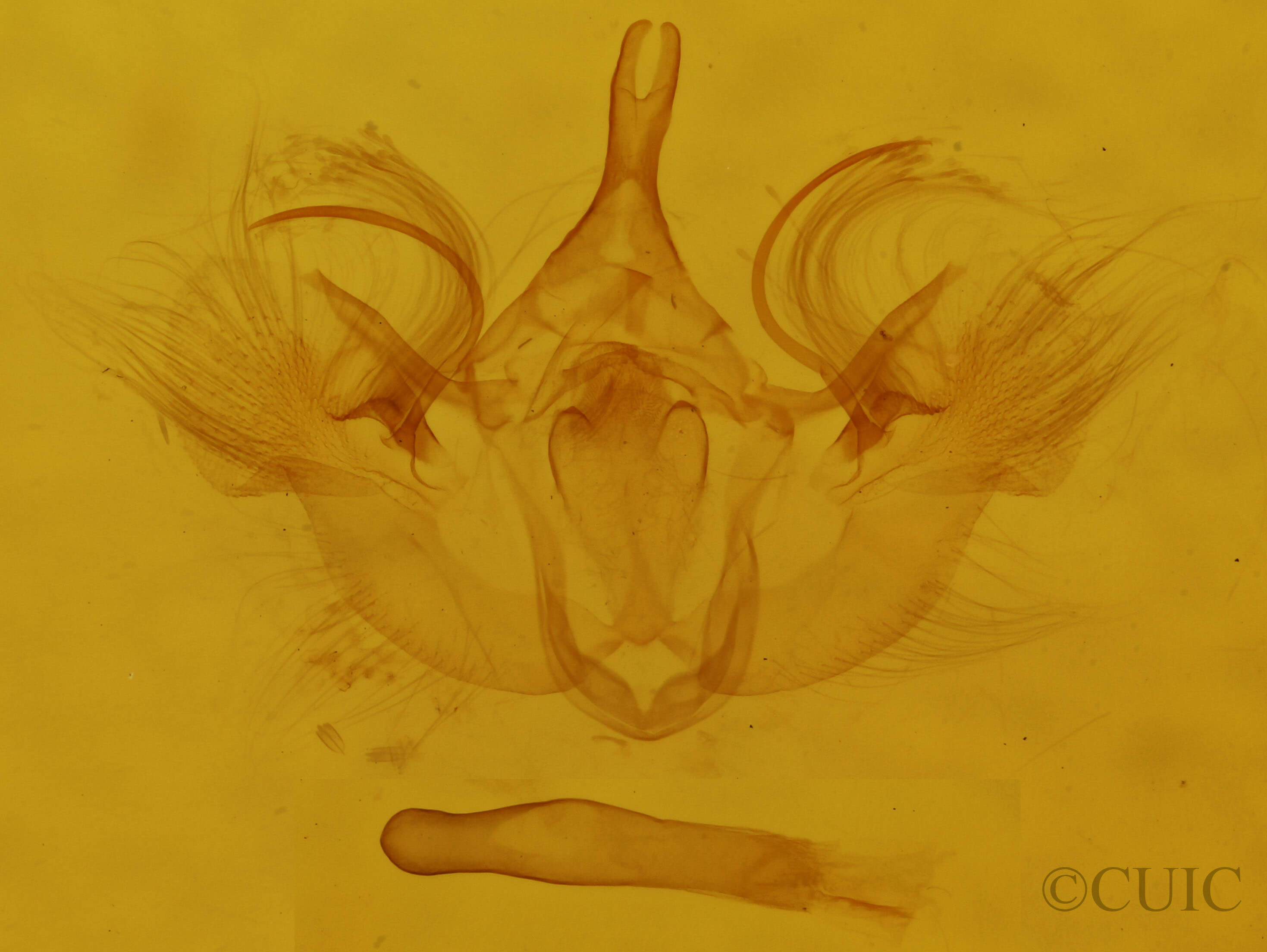 genitalia view of adult Hydriomena