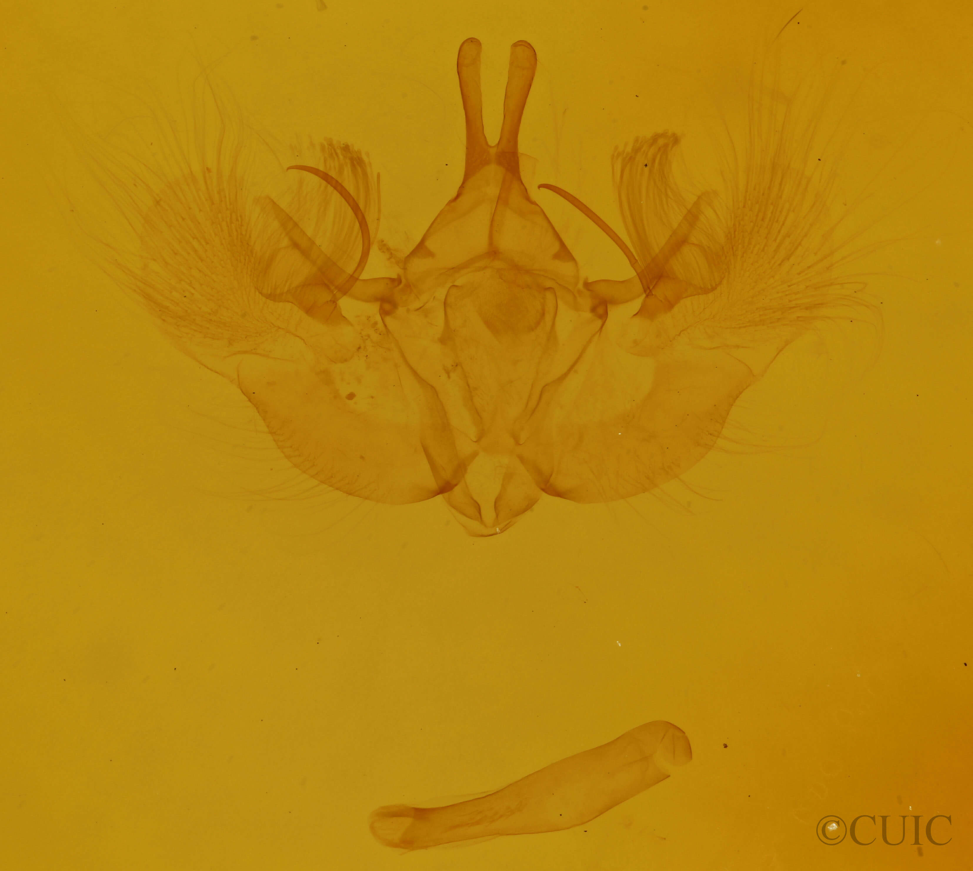 genitalia view of adult Hydriomena renunciata