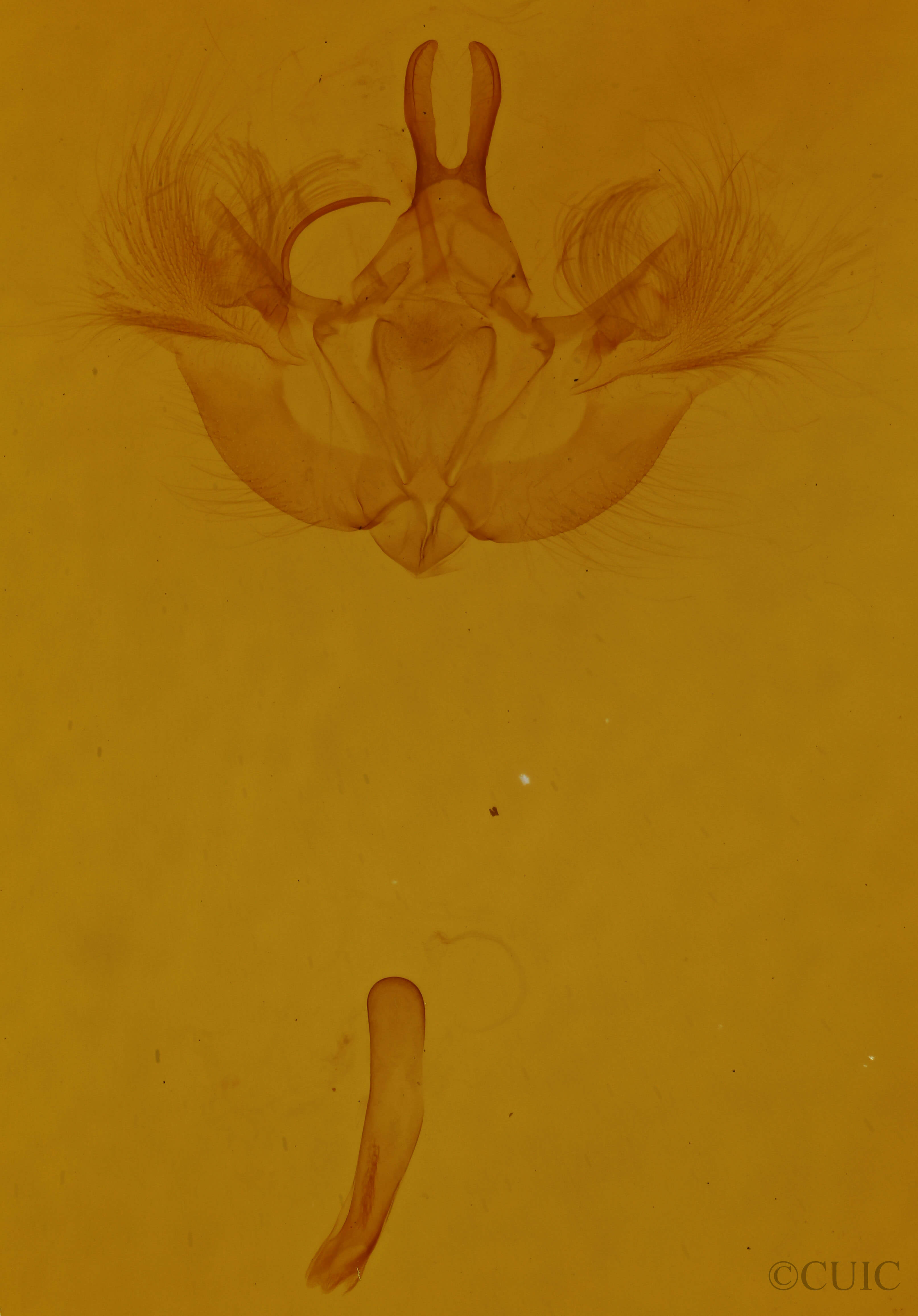 genitalia view of adult Hydriomena renunciata